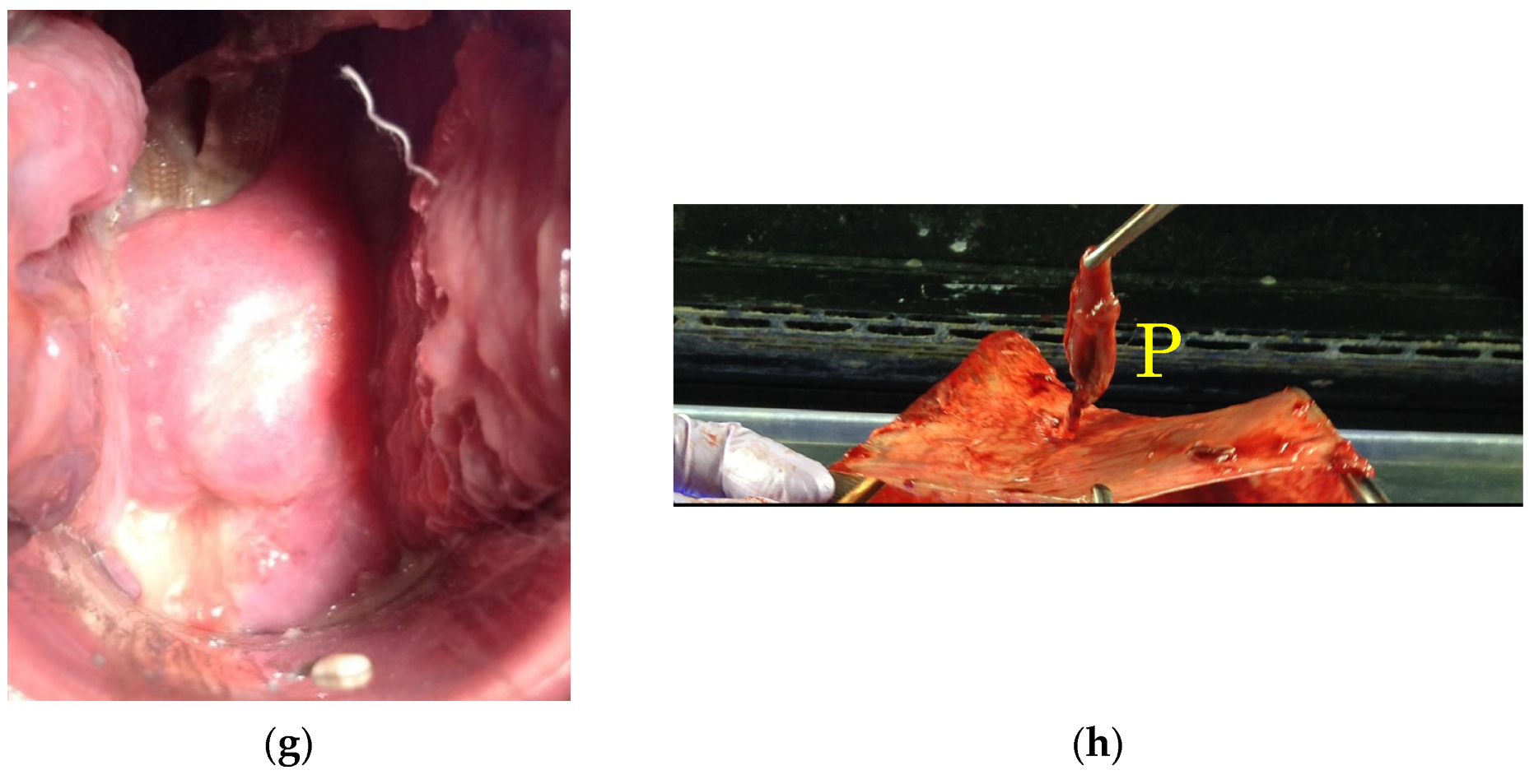 Healthcare 10 01312 g003b 550