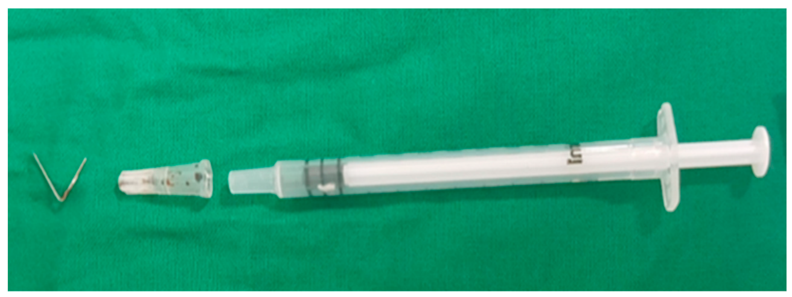 Healthcare Free FullText Broken Needle Embedded in the Body during