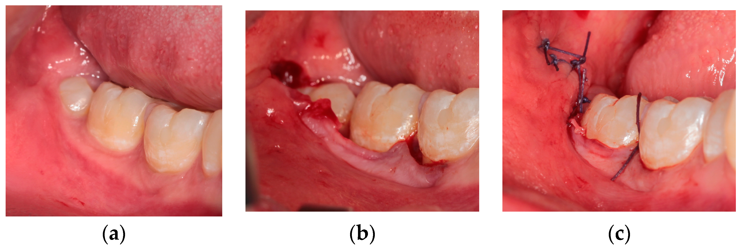 Healthcare 10 01587 g003