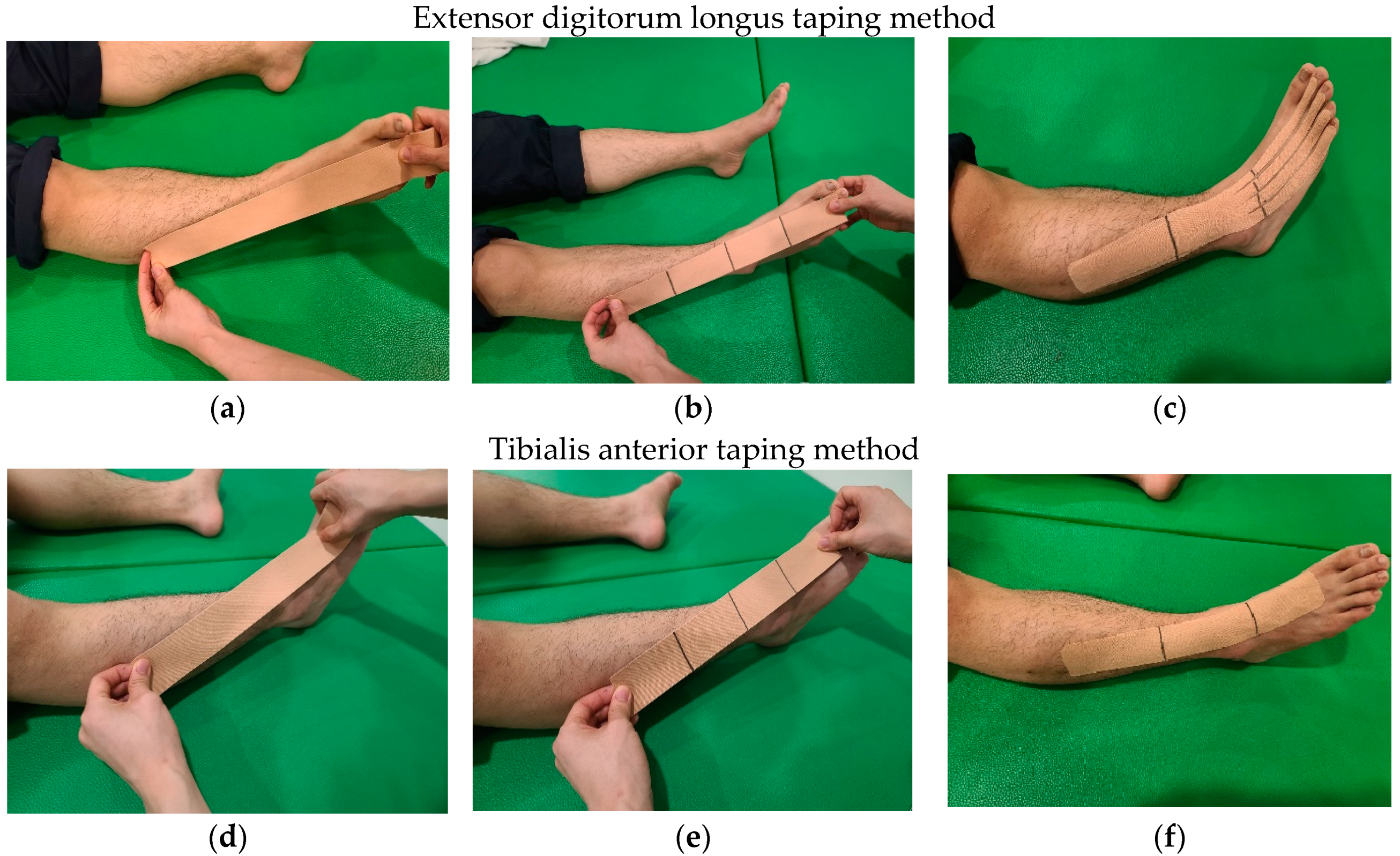 Taping & Strapping Techniques