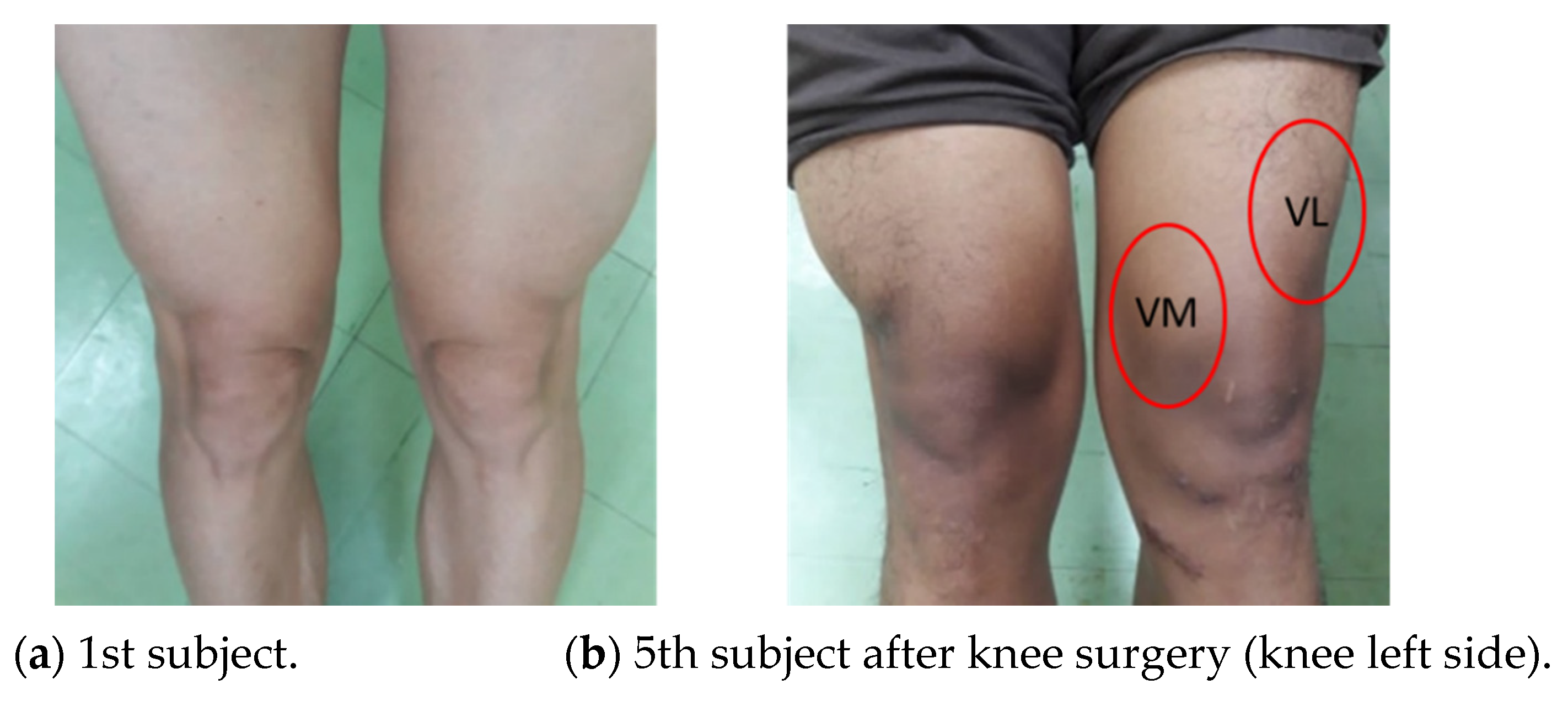 Healthcare 10 02544 g011 Healthcare 10 02544 g011