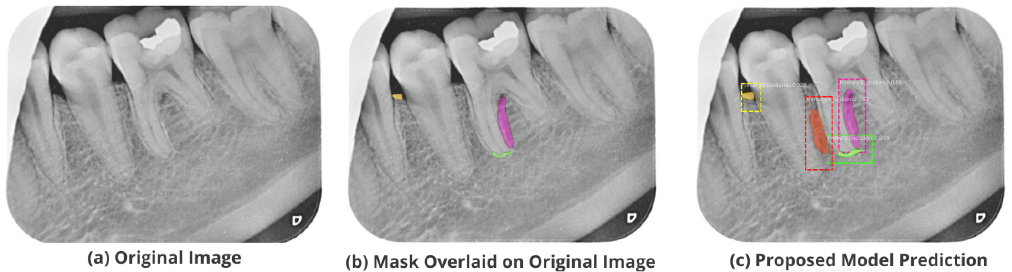 Healthcare 11 00347 g011