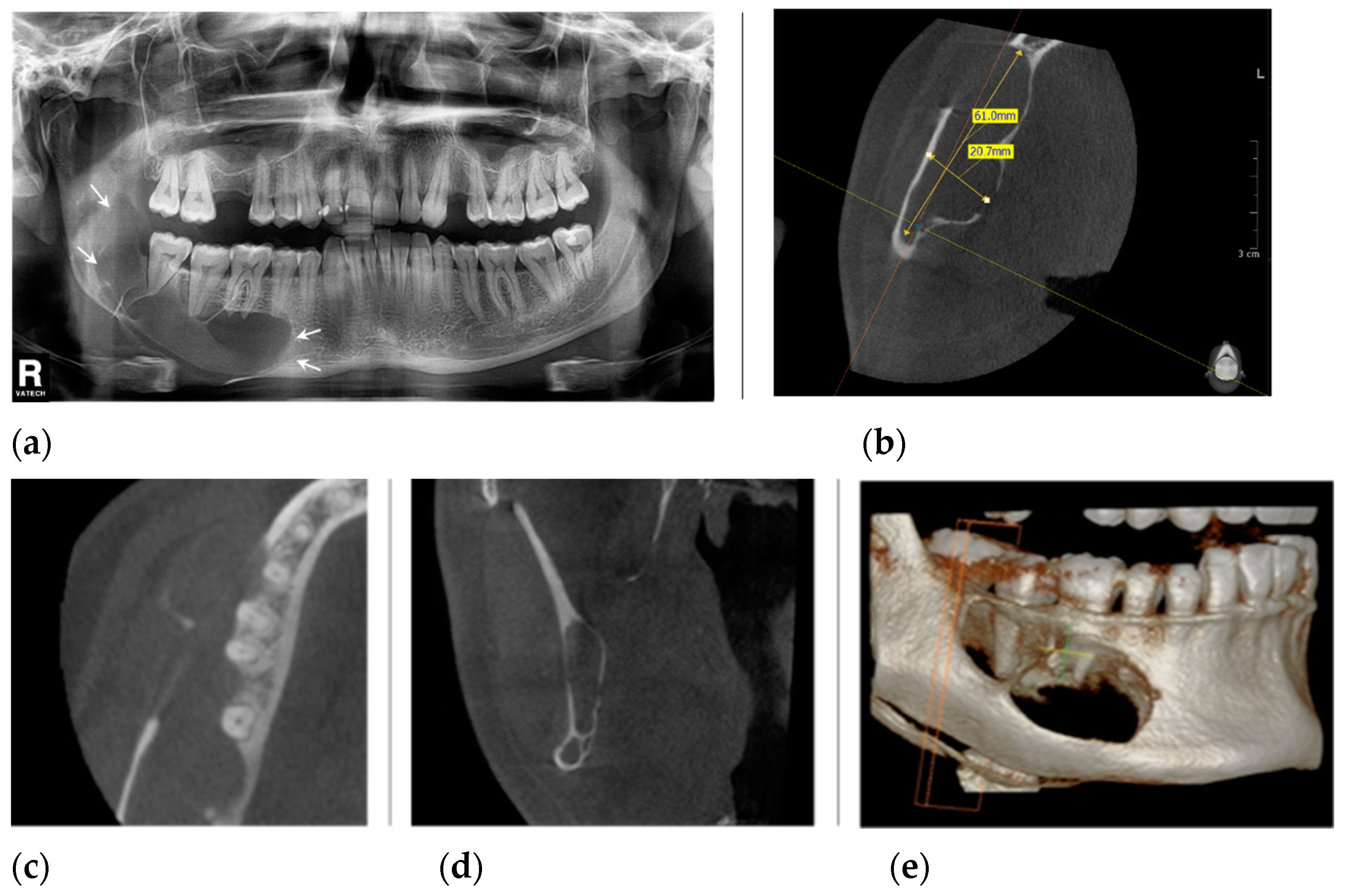Healthcare 11 00416 g002