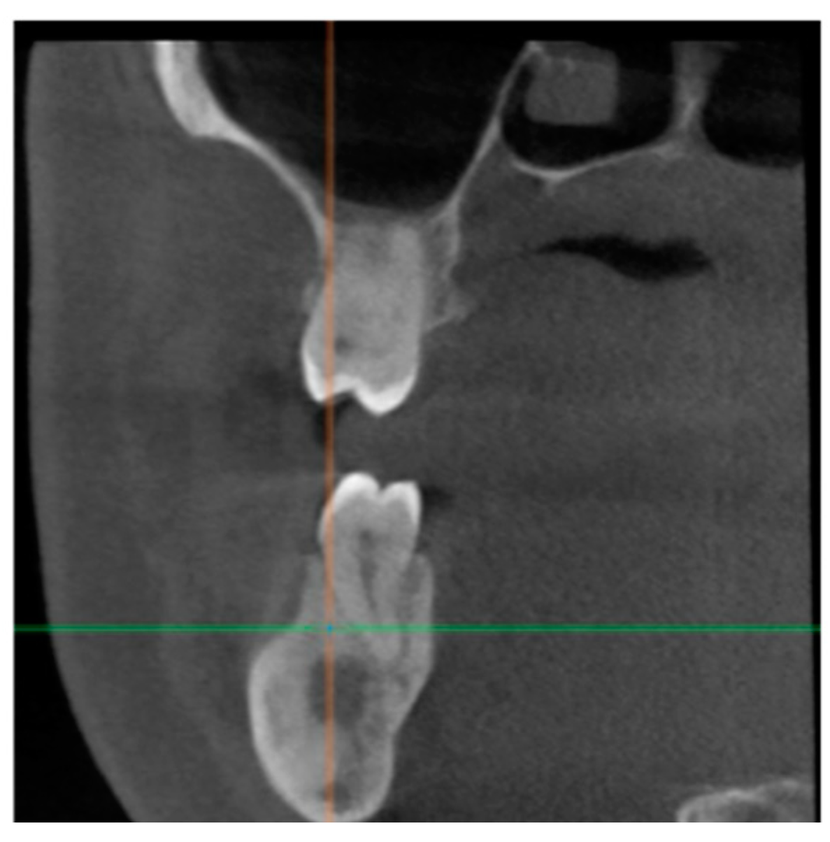 Healthcare 11 00416 g005