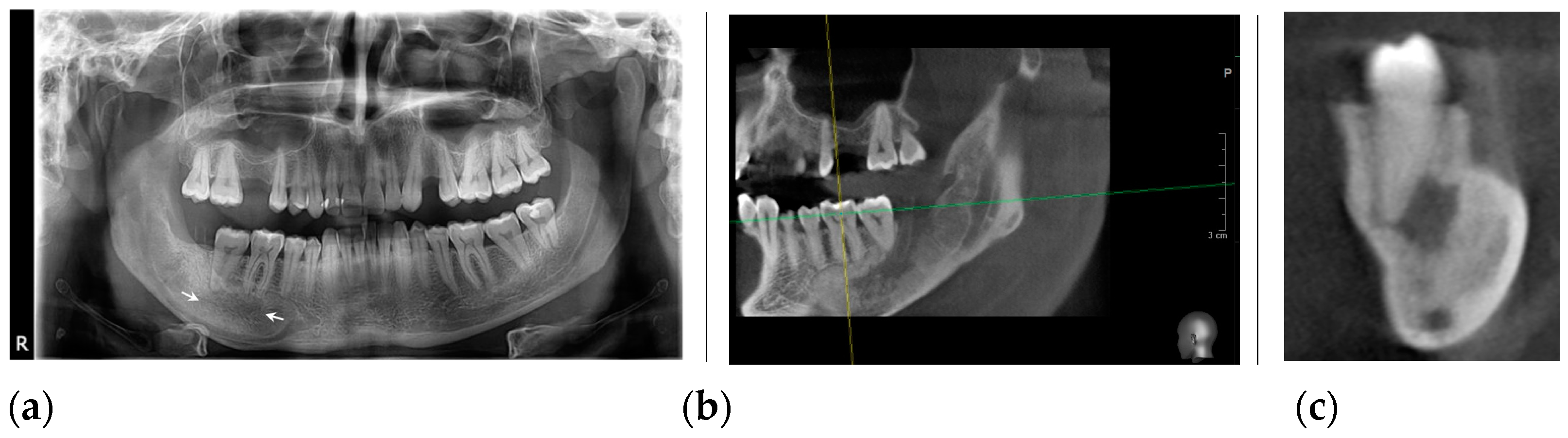 Healthcare 11 00416 g006