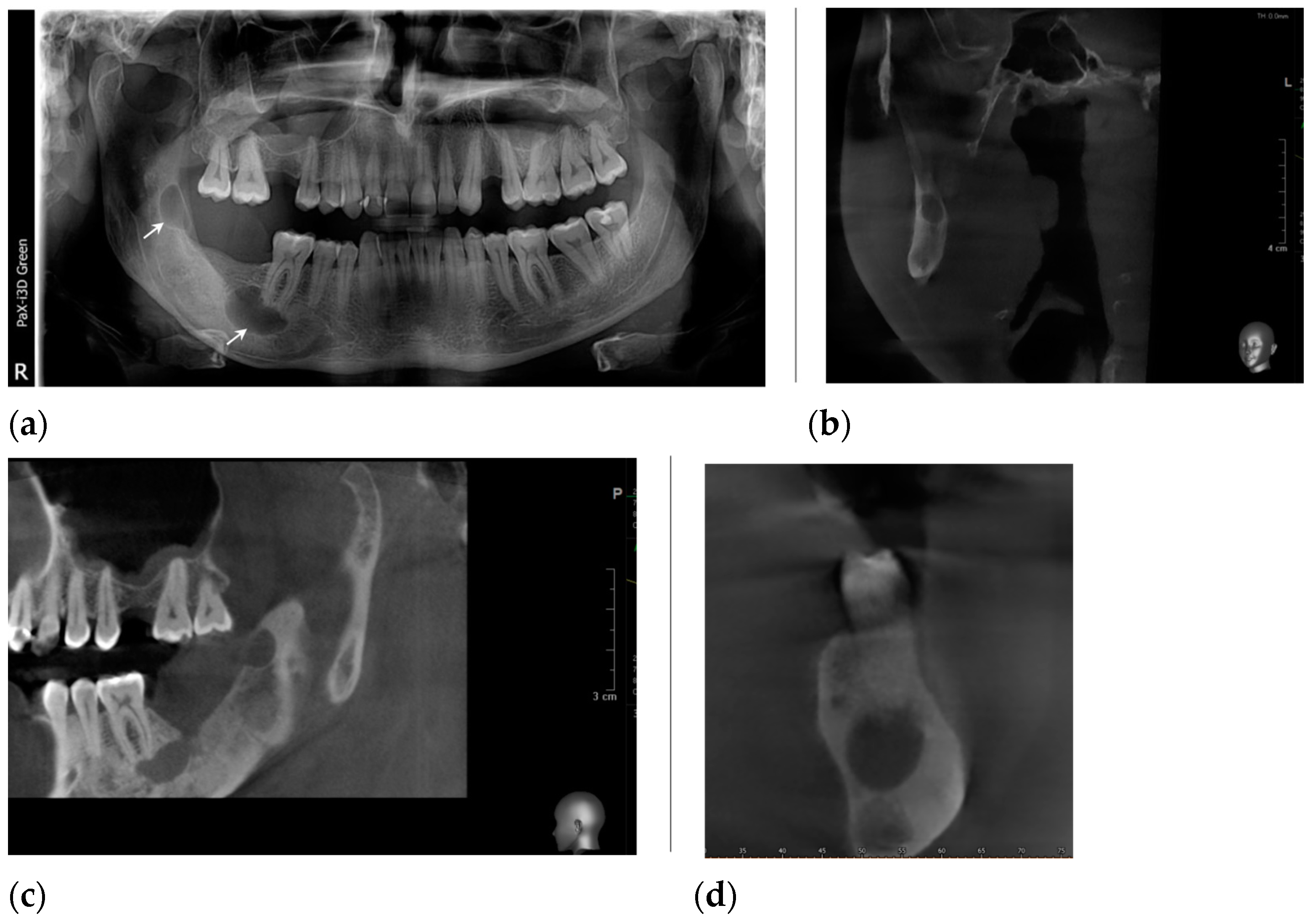 Healthcare 11 00416 g008