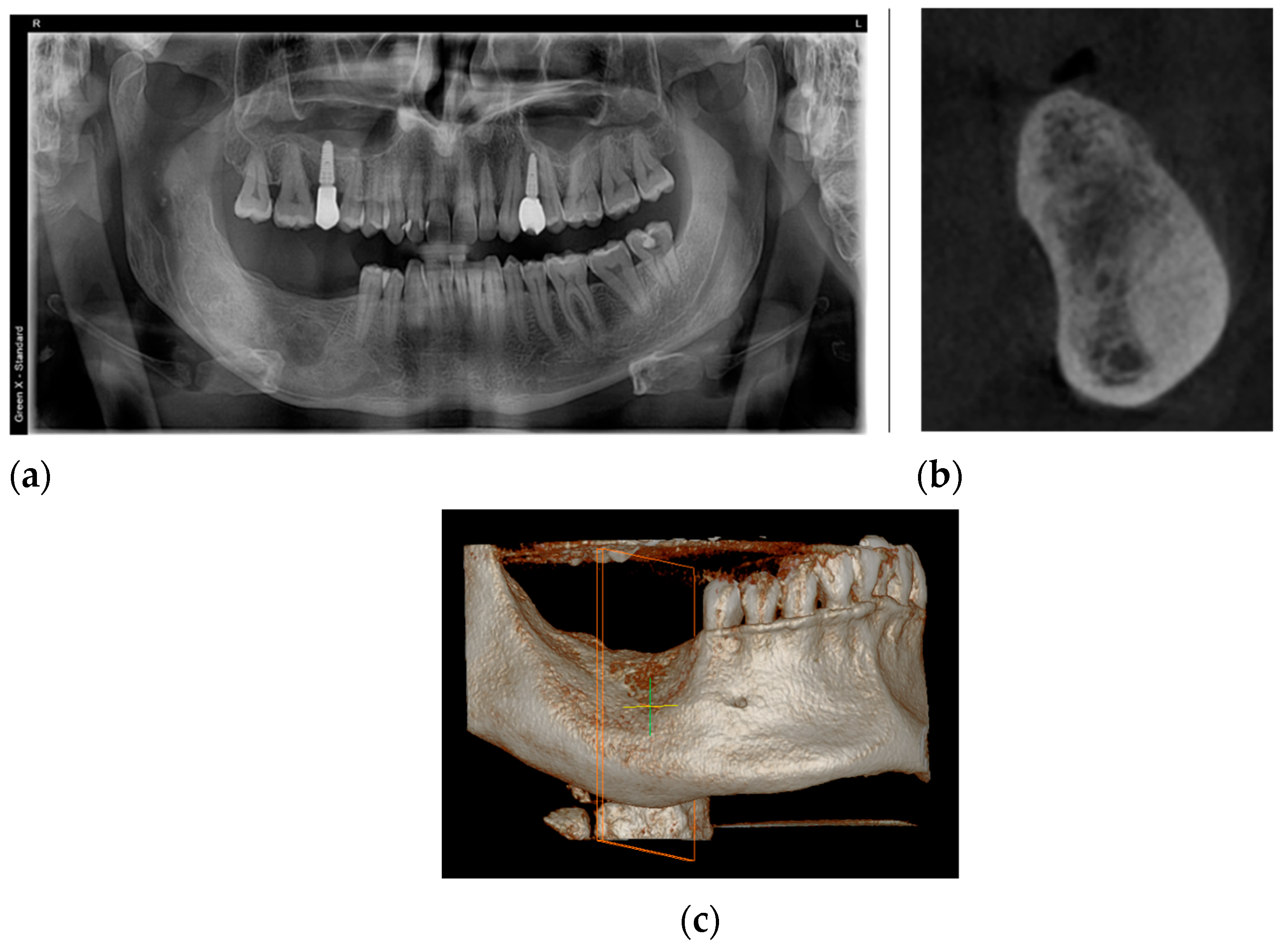 Healthcare 11 00416 g011