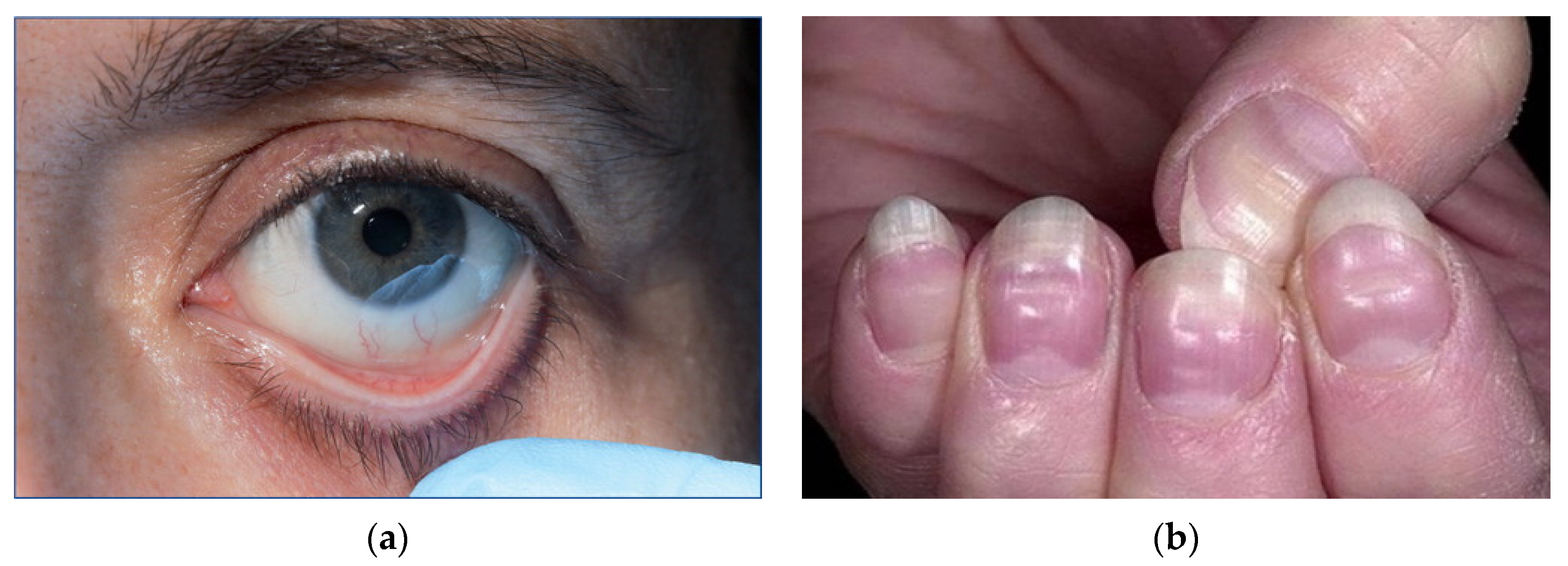 Healthcare 11 00697 g006 Healthcare 11 00697 g006