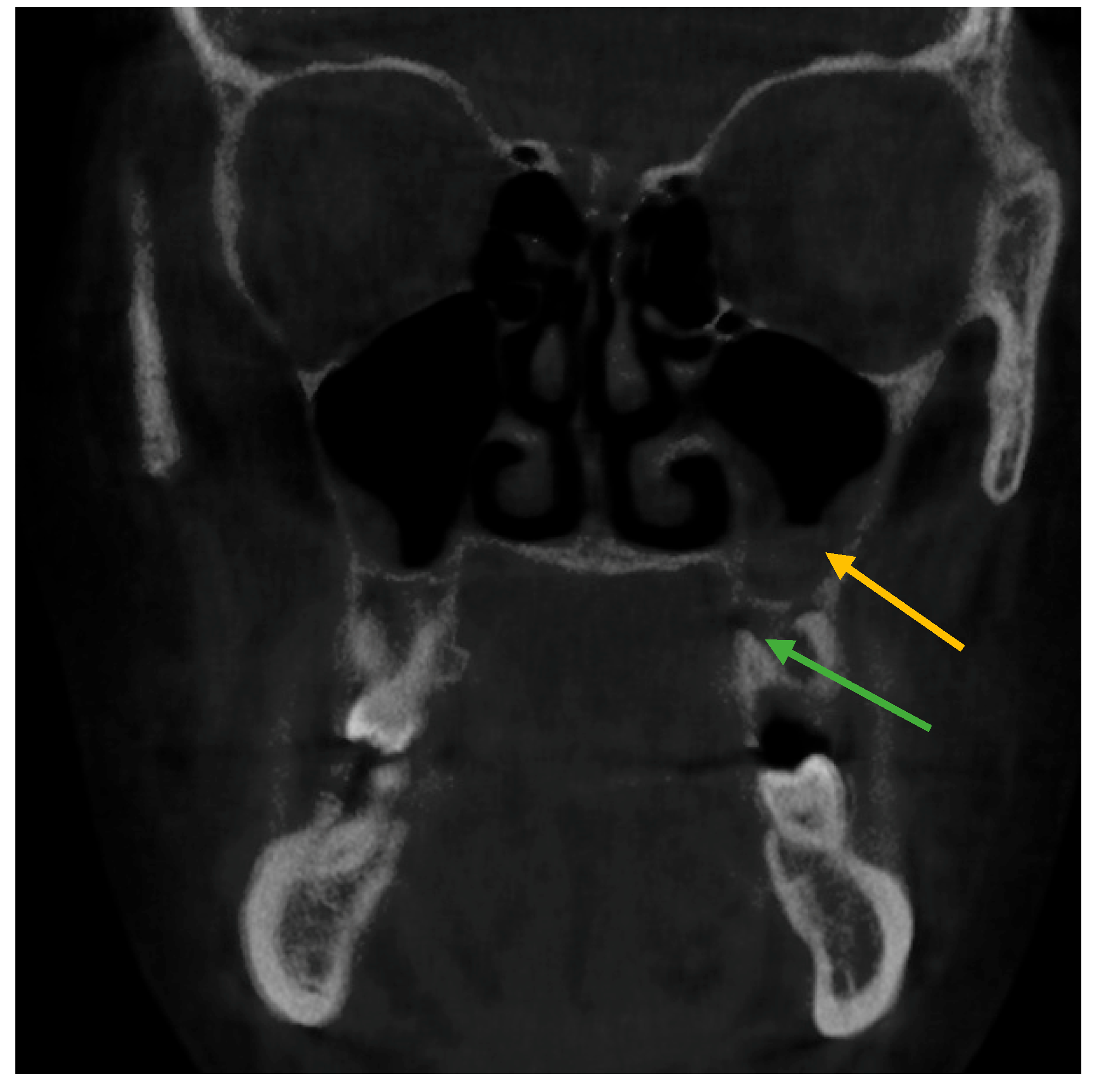 Healthcare 11 00787 g001 Healthcare 11 00787 g001