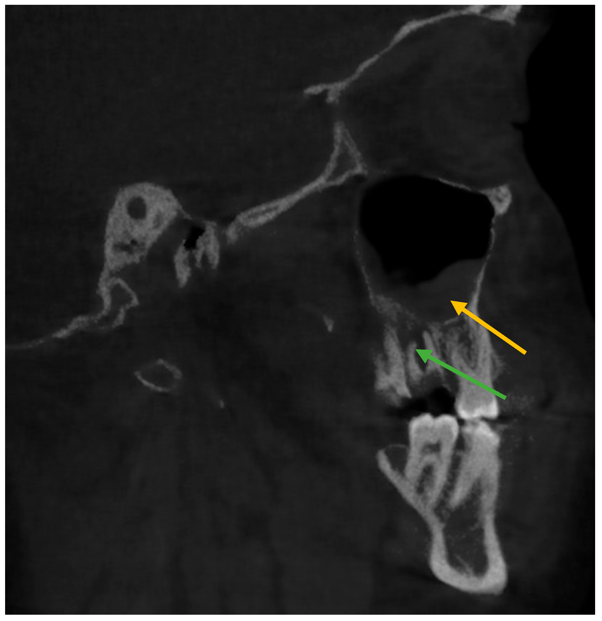 Healthcare 11 00787 g002 Healthcare 11 00787 g002