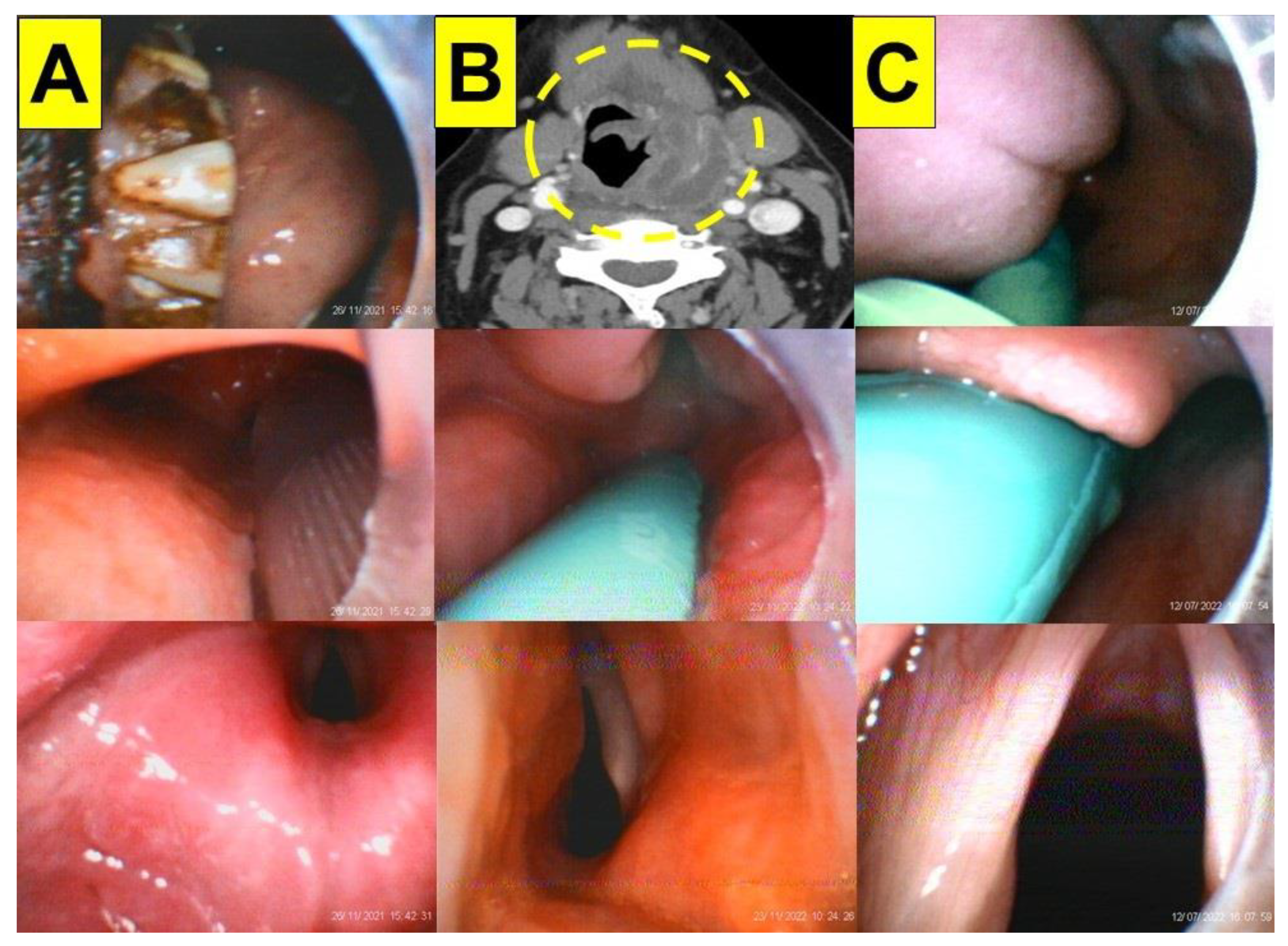 Healthcare 11 00891 g005