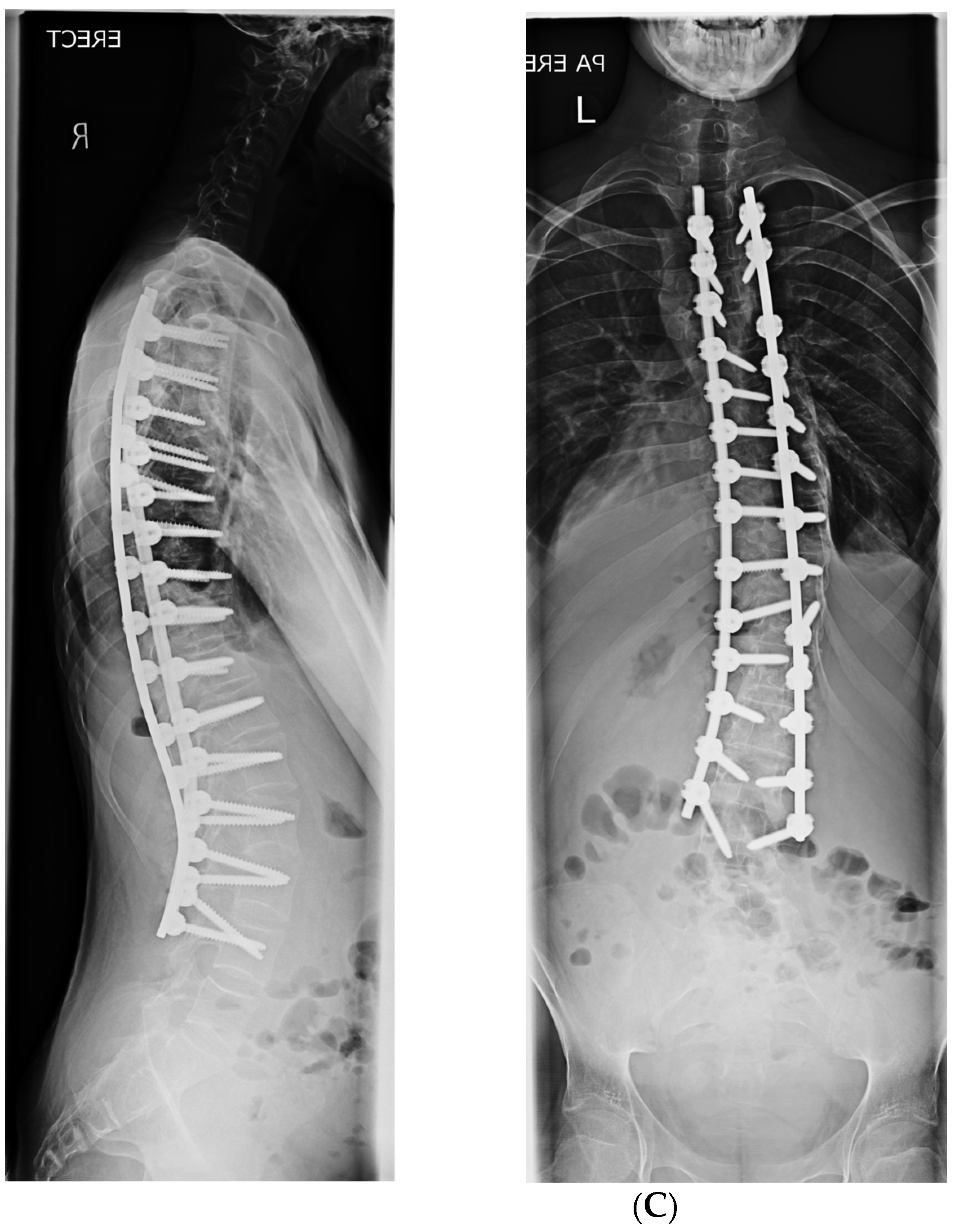 Healthcare 11 00980 g006b