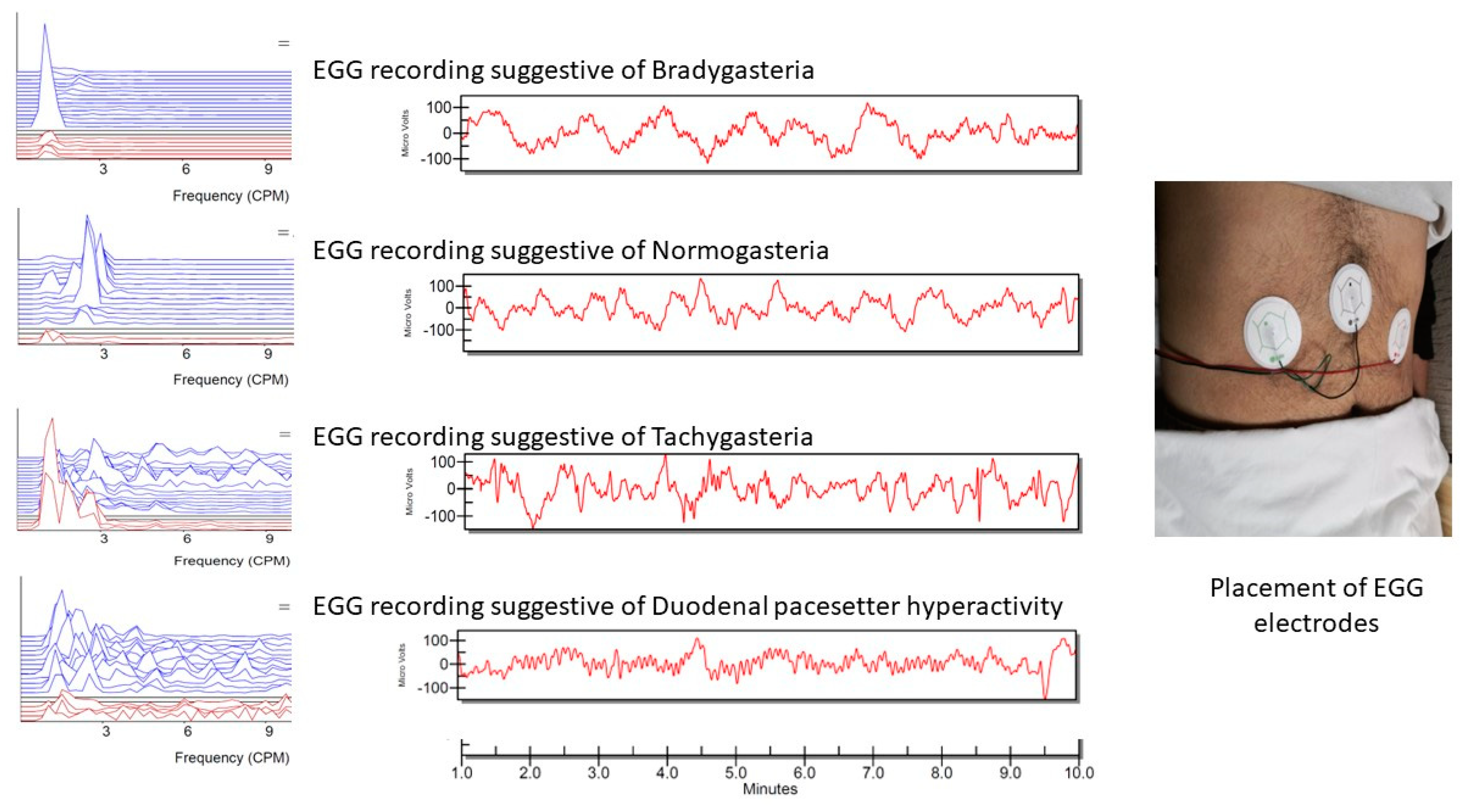 Healthcare 11 01105 g002 Healthcare 11 01105 g002