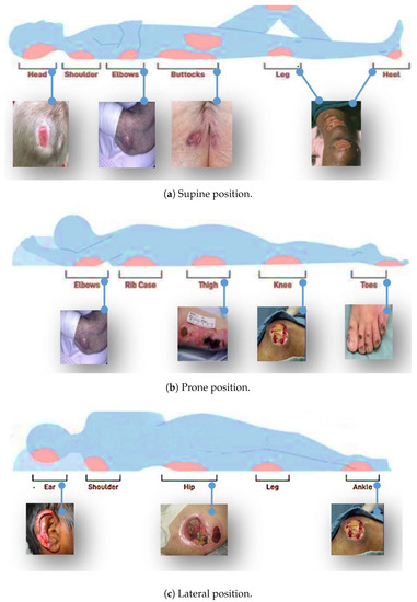 Wounds - Dermatology - Medbullets Step 2/3