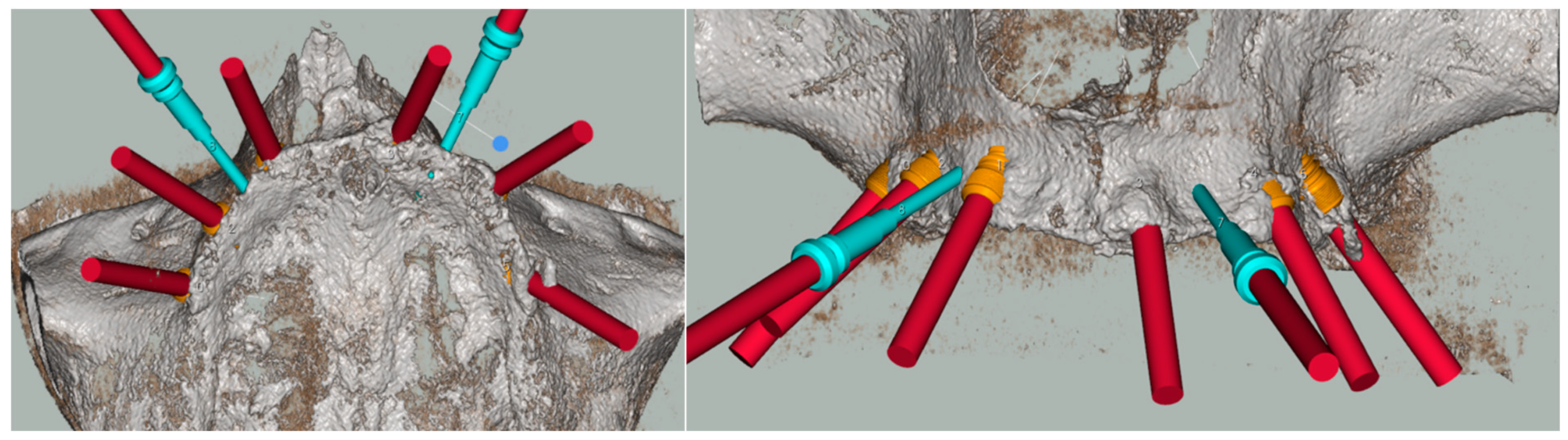 Healthcare 11 01301 g004 Healthcare 11 01301 g004