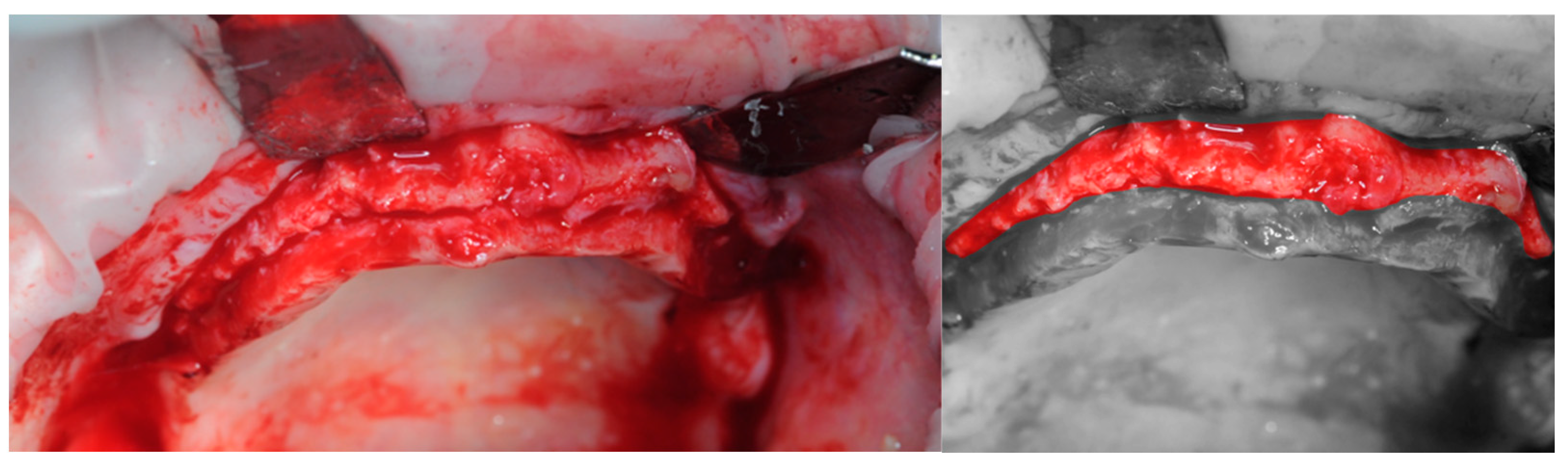 Healthcare 11 01301 g008 Healthcare 11 01301 g008