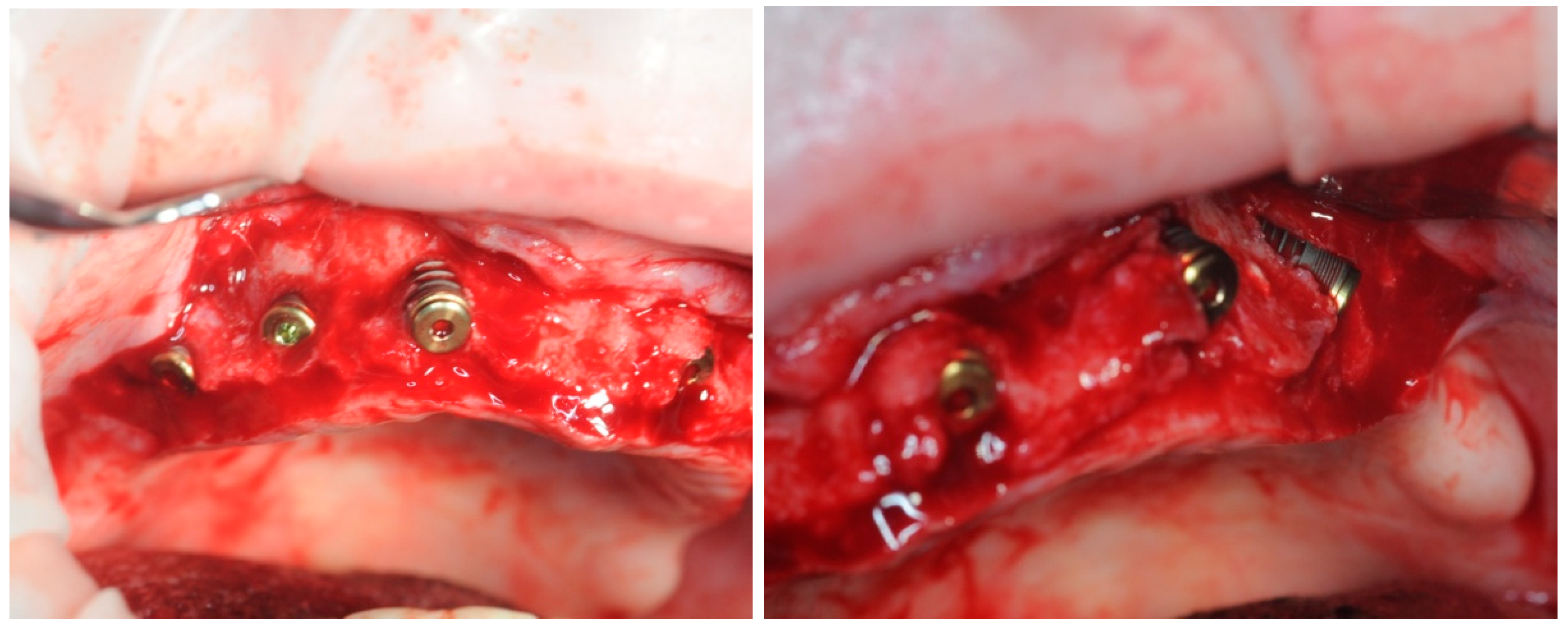 Healthcare 11 01301 g009 Healthcare 11 01301 g009