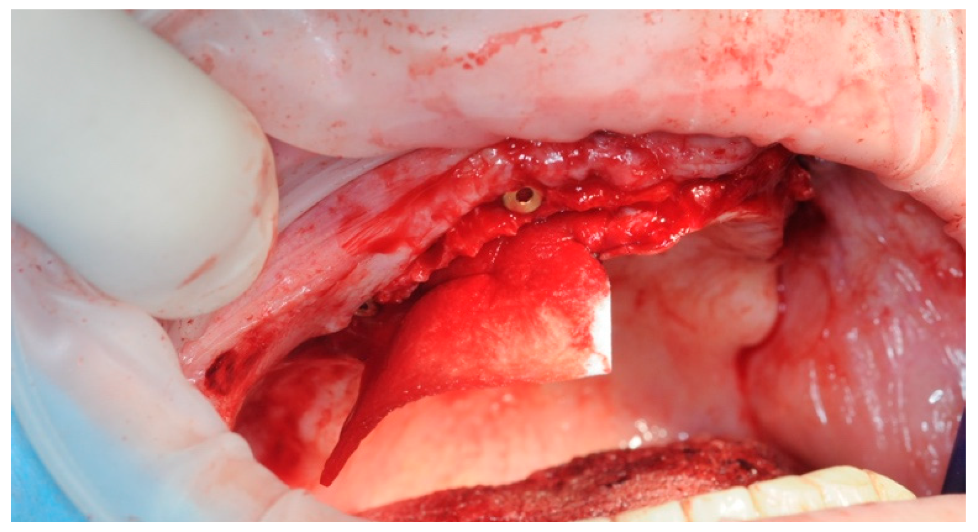 Healthcare 11 01301 g010 Healthcare 11 01301 g010