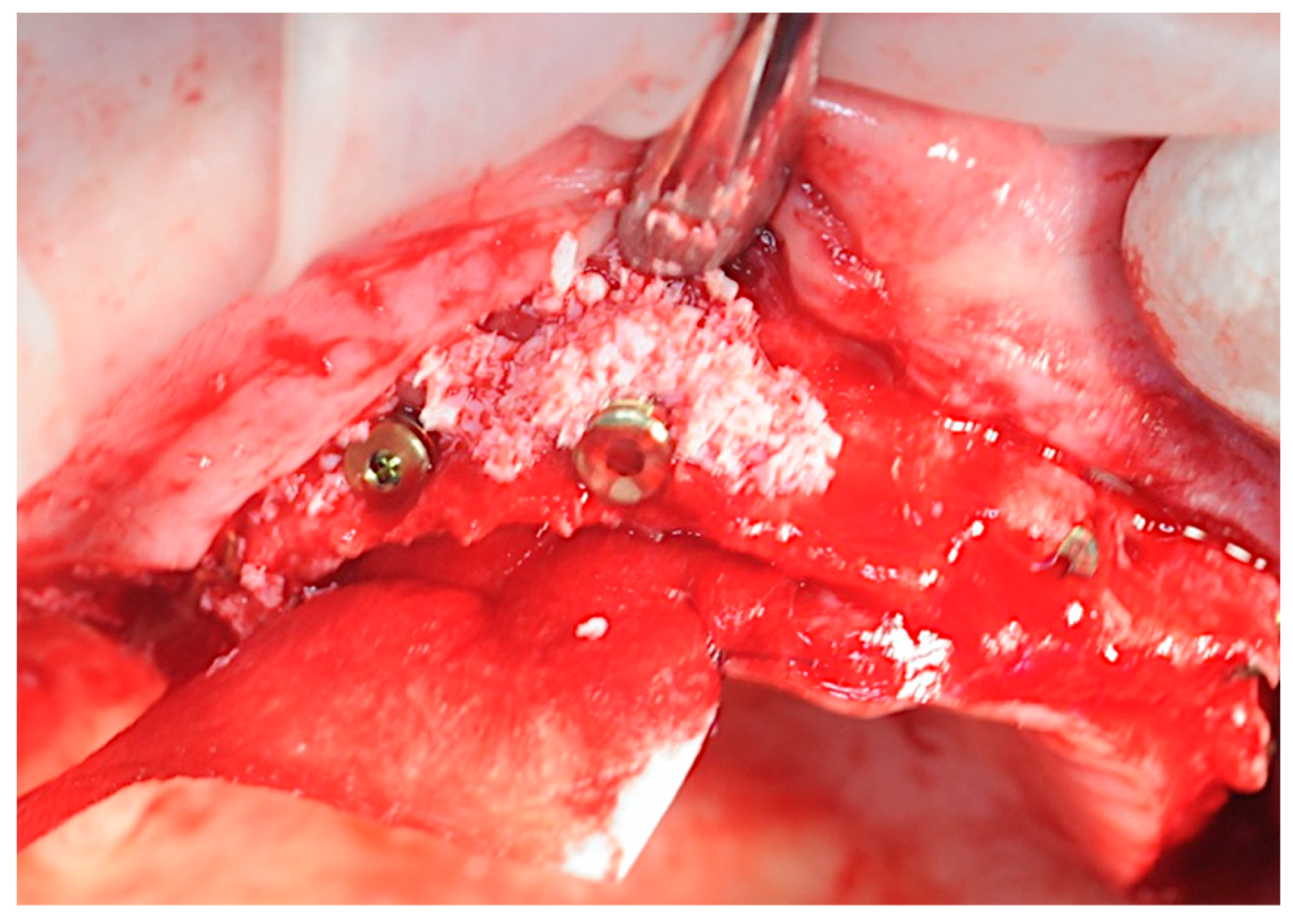 Healthcare 11 01301 g011 Healthcare 11 01301 g011