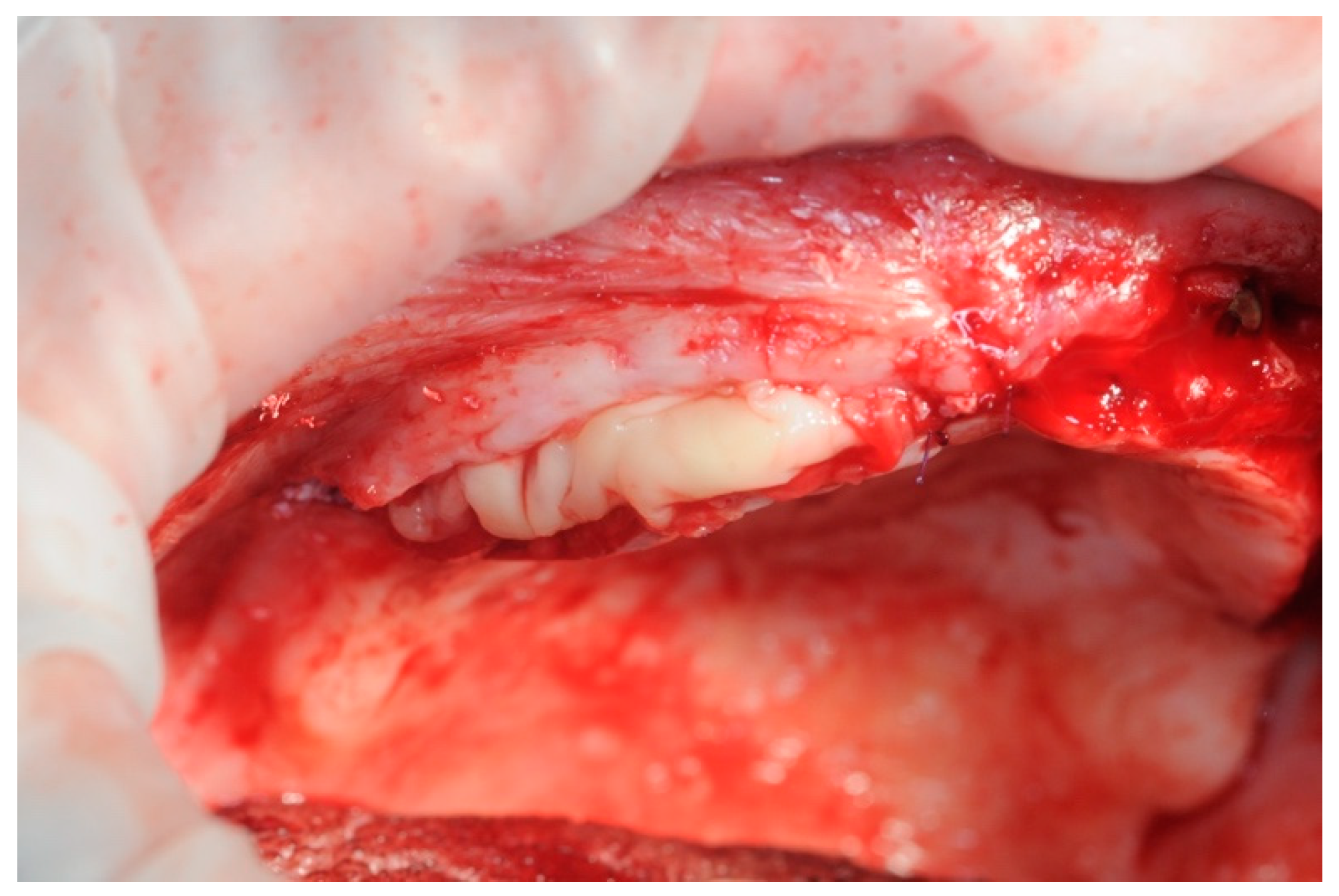 Healthcare 11 01301 g012 Healthcare 11 01301 g012