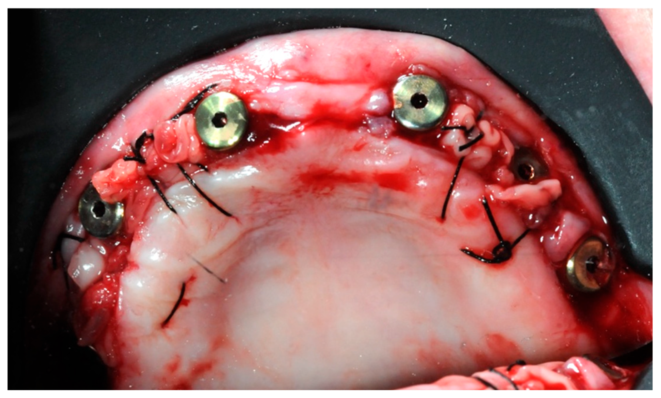 Healthcare 11 01301 g016 Healthcare 11 01301 g016