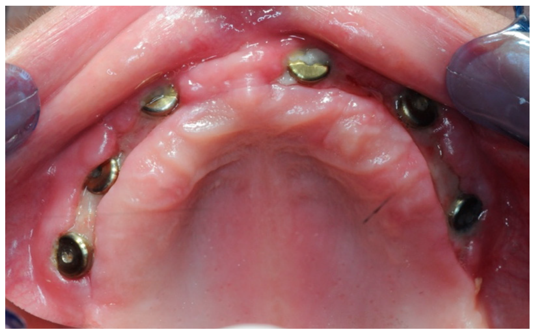 Healthcare 11 01301 g017 Healthcare 11 01301 g017