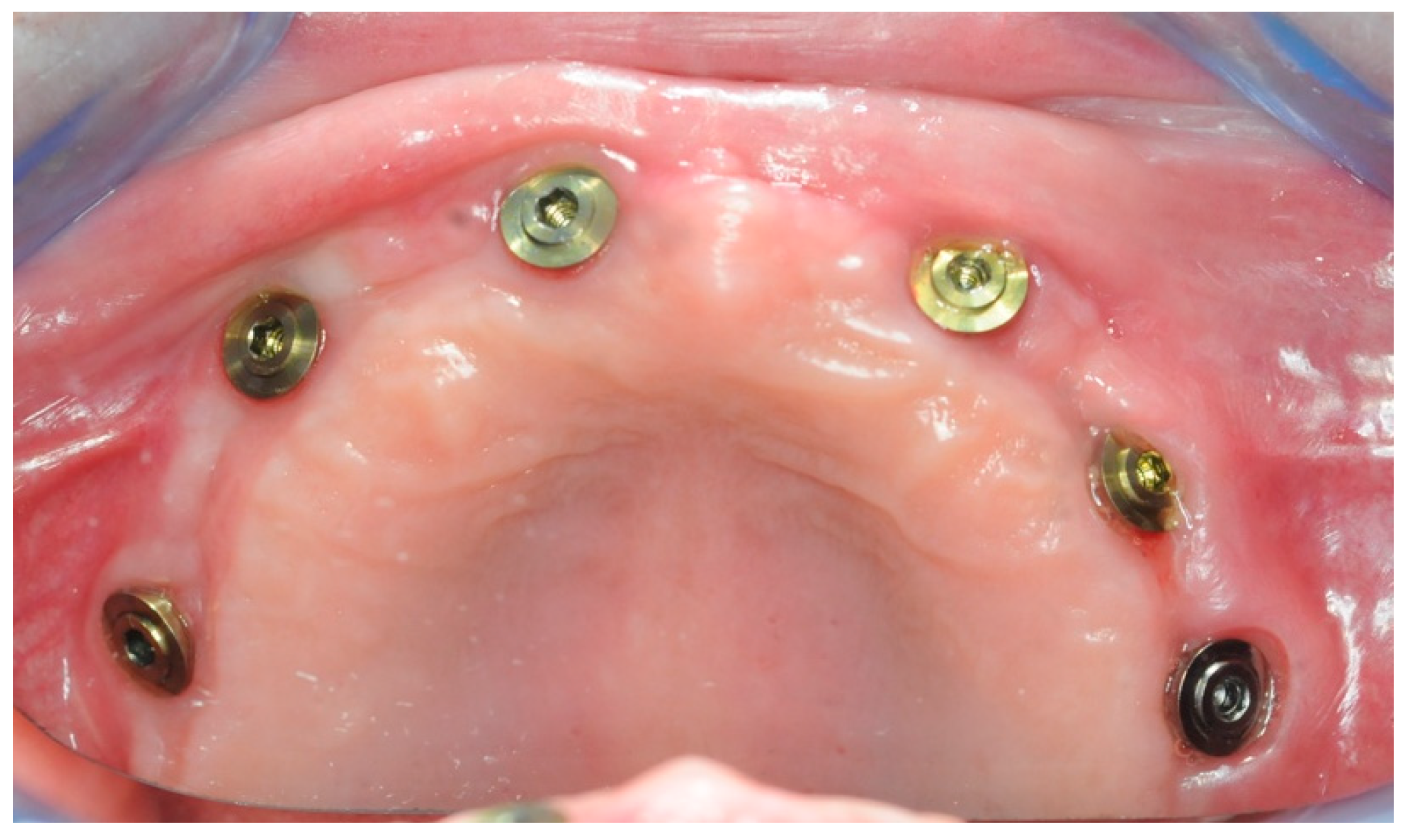 Healthcare 11 01301 g018 Healthcare 11 01301 g018