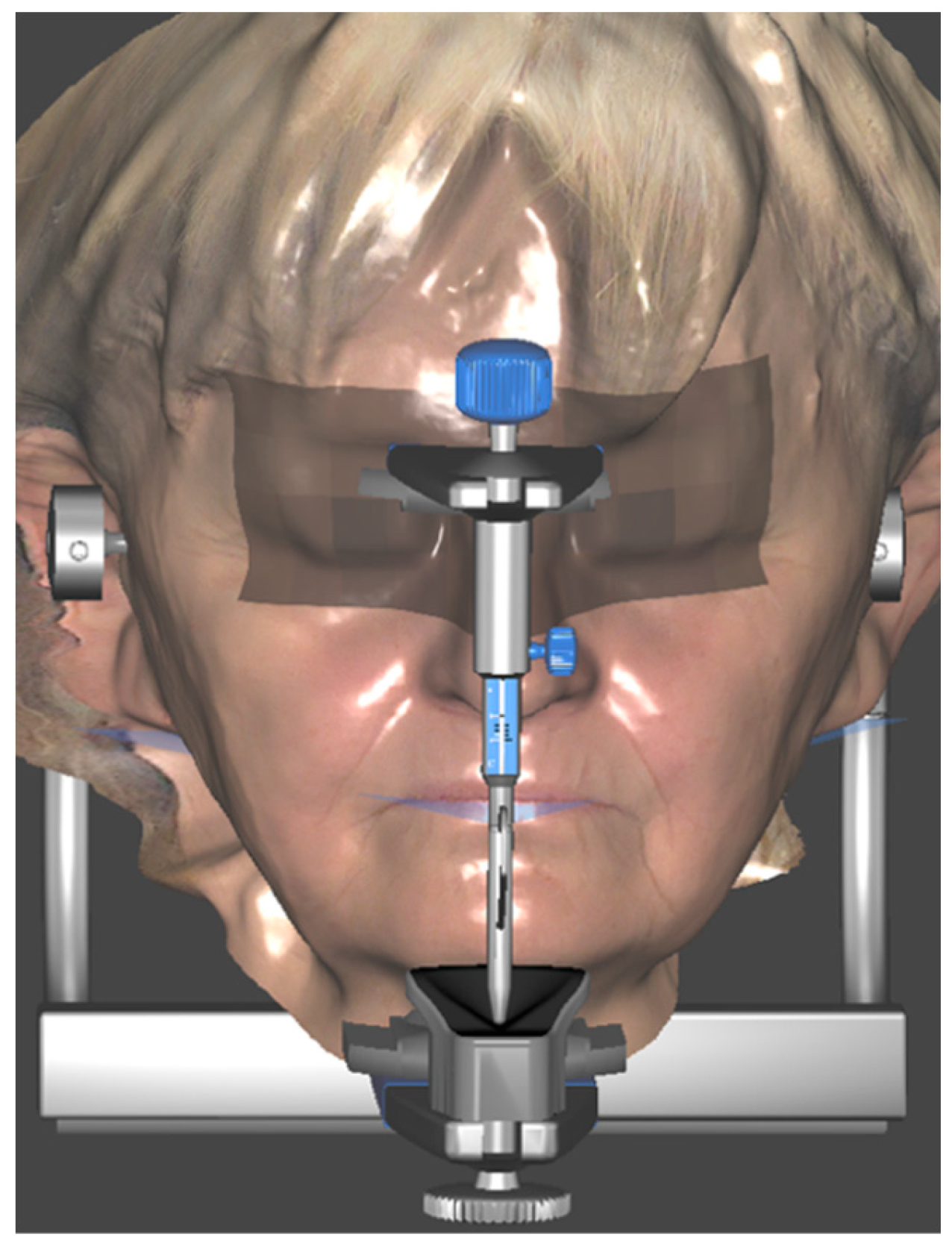 Healthcare 11 01301 g021 Healthcare 11 01301 g021