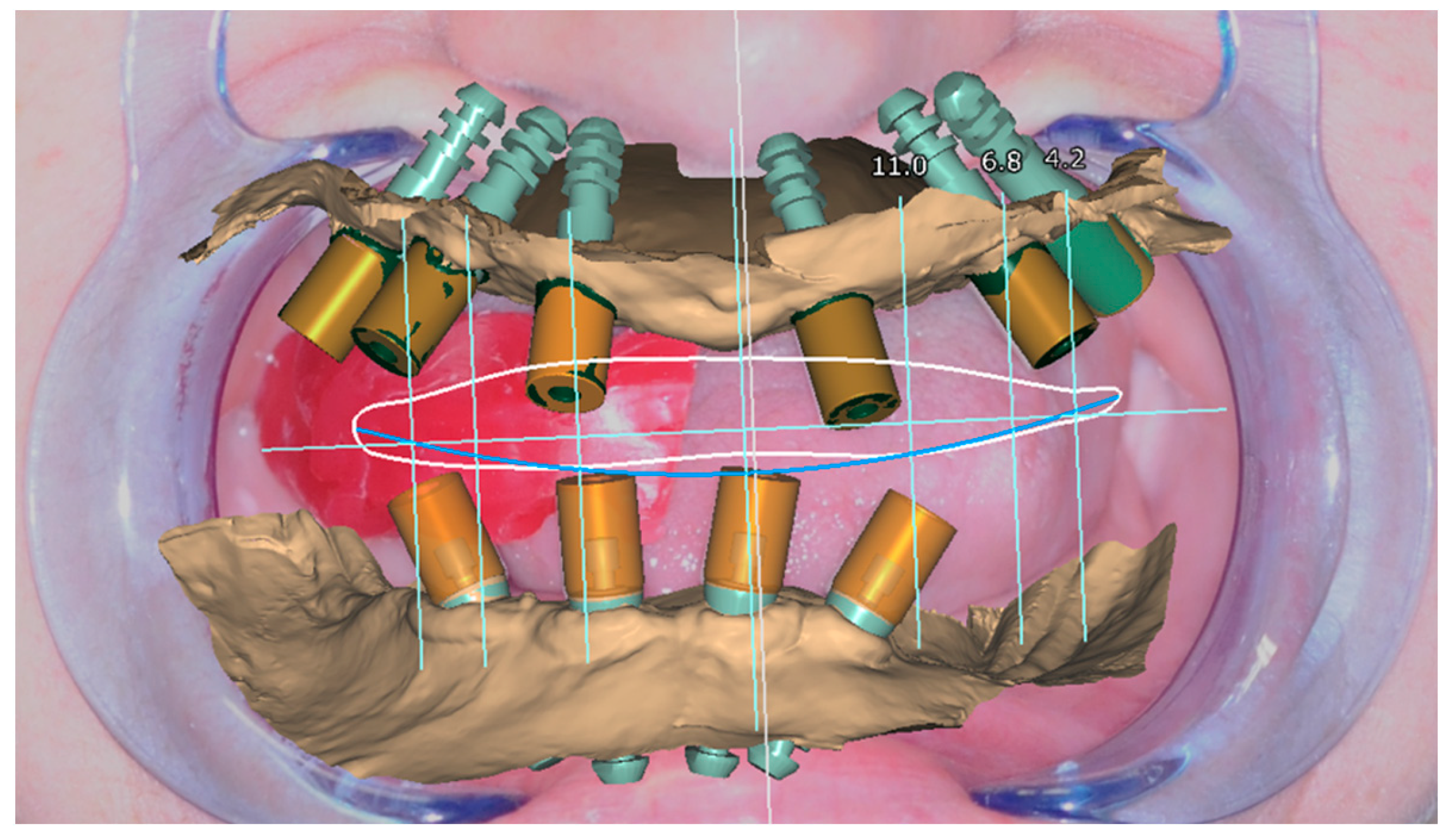 Healthcare 11 01301 g022 Healthcare 11 01301 g022