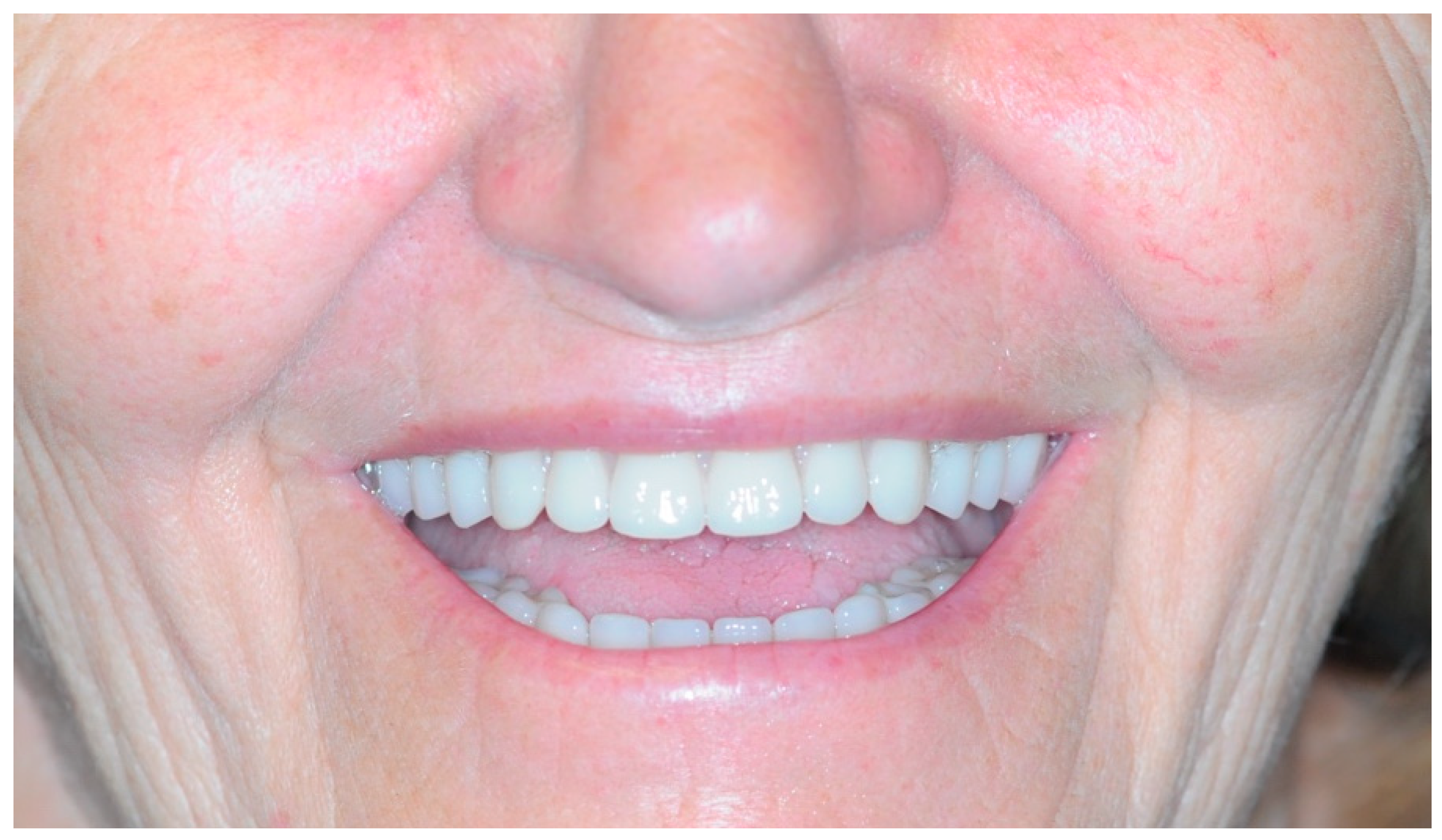 Healthcare 11 01301 g028 Healthcare 11 01301 g028