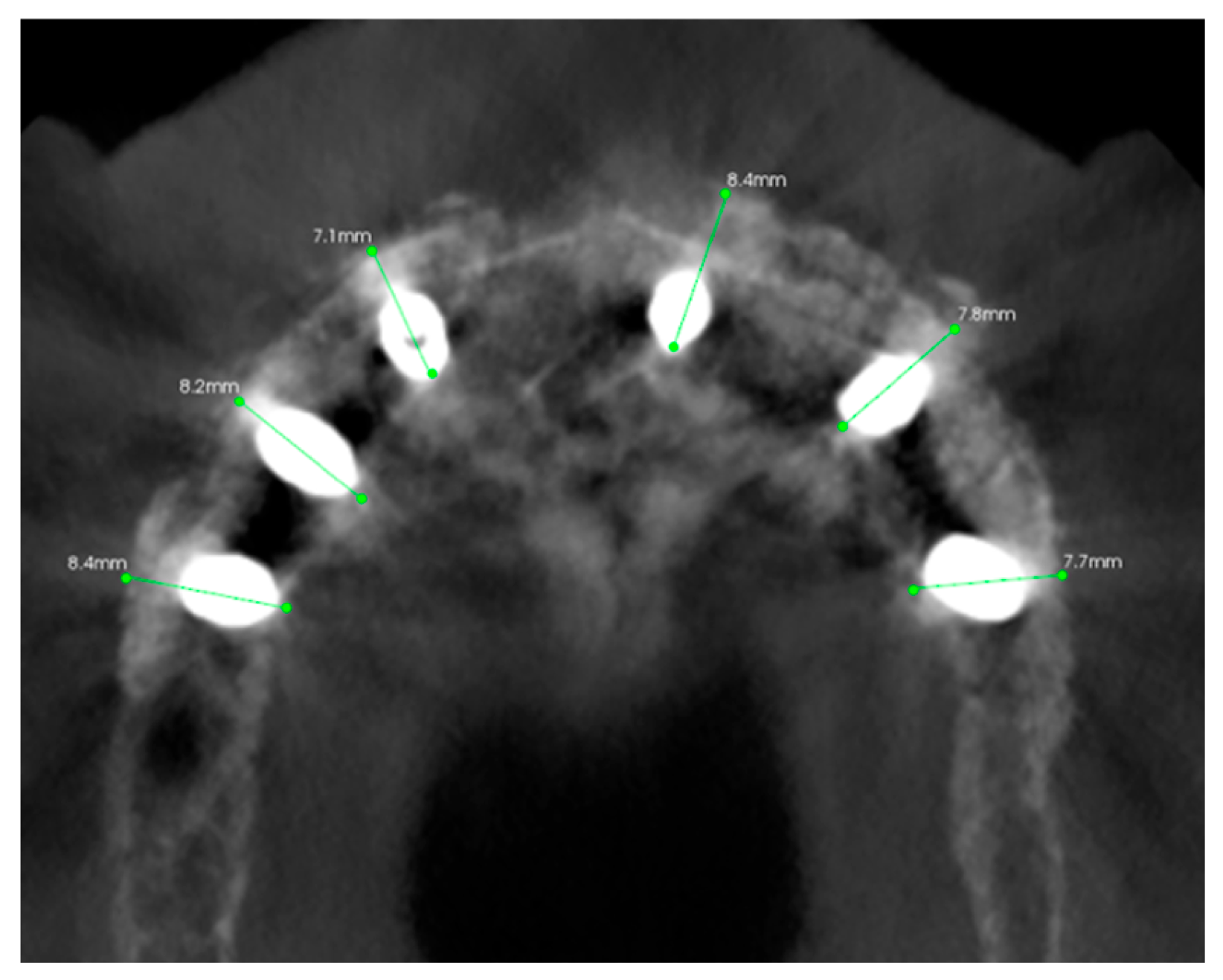 Healthcare 11 01301 g032 Healthcare 11 01301 g032