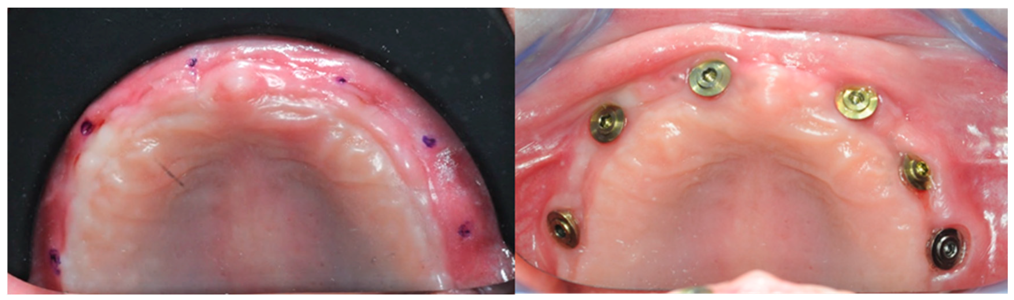 Healthcare 11 01301 g033 Healthcare 11 01301 g033