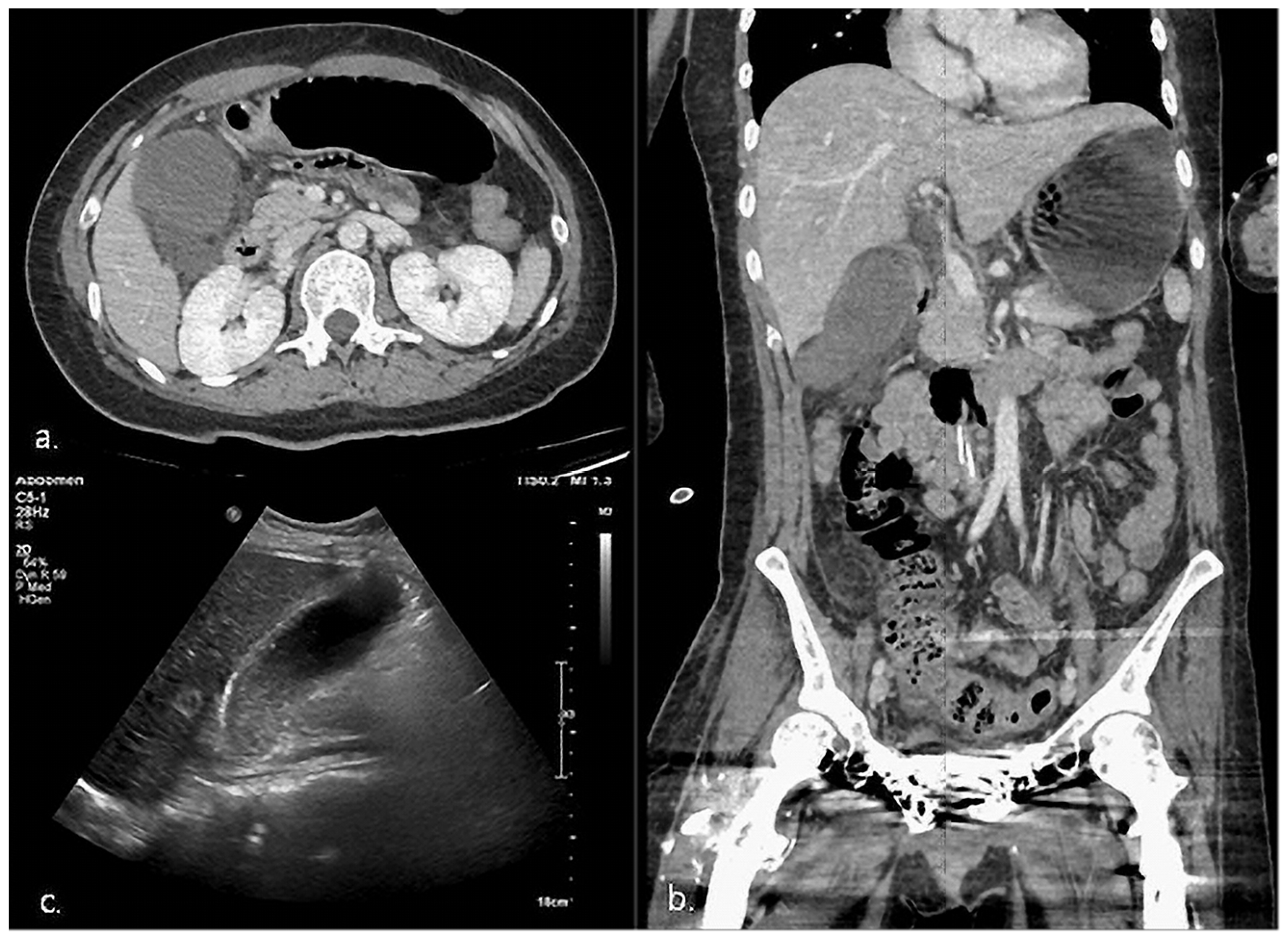 Healthcare 11 01378 g002 Healthcare 11 01378 g002