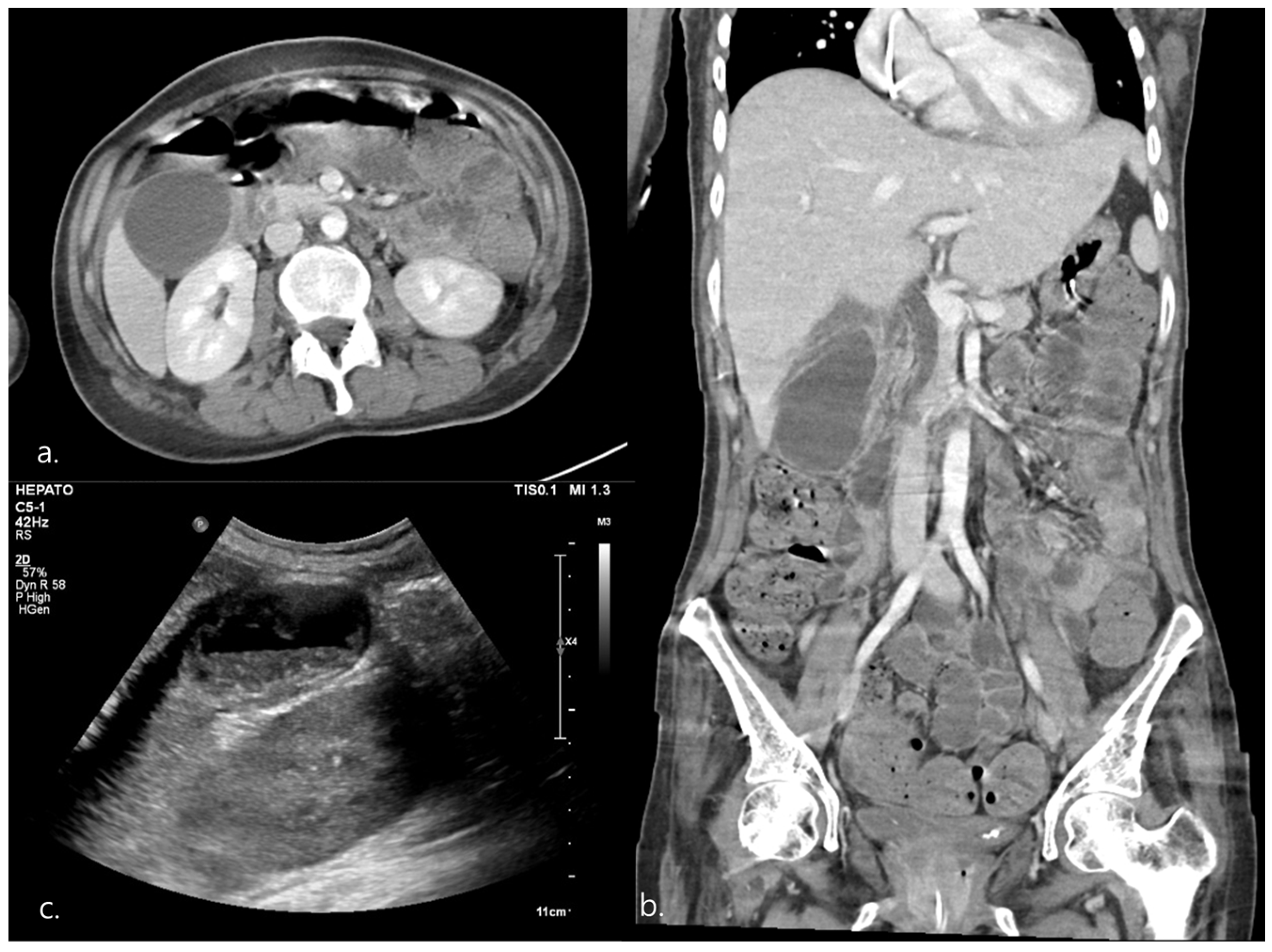 Healthcare 11 01378 g004 Healthcare 11 01378 g004