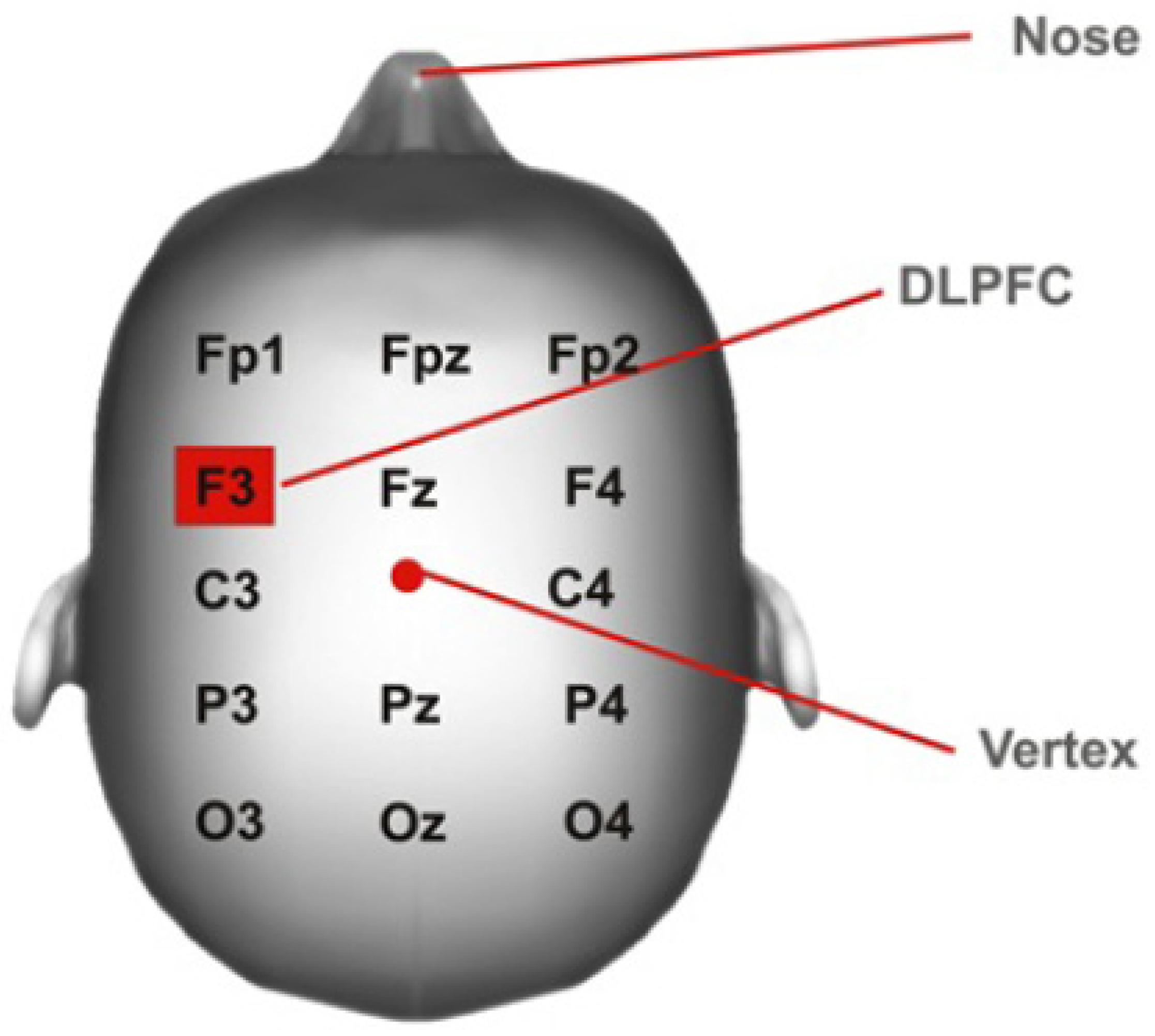 dorsolateral prefrontal cortex tdcs