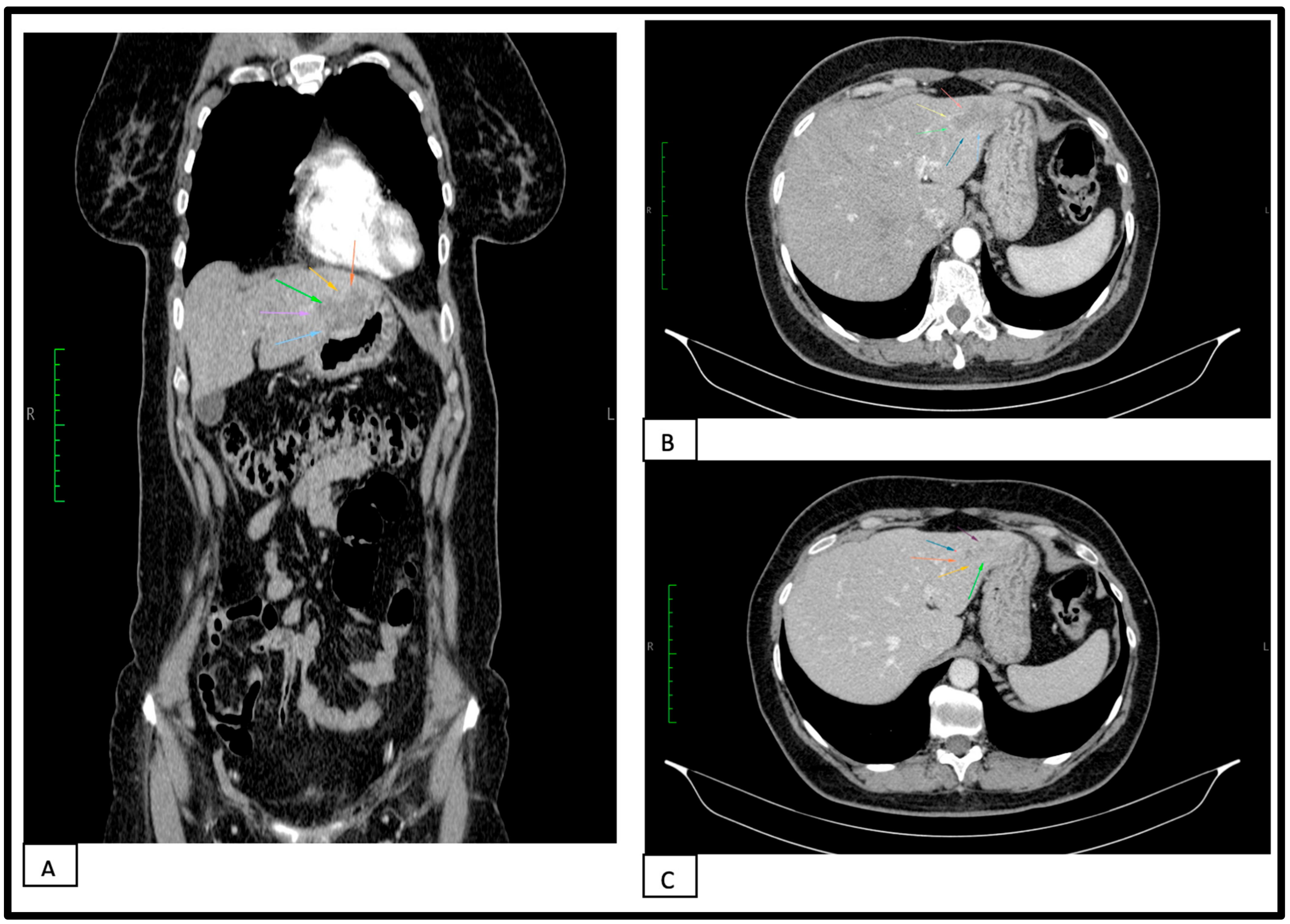Healthcare 11 01451 g002 Healthcare 11 01451 g002