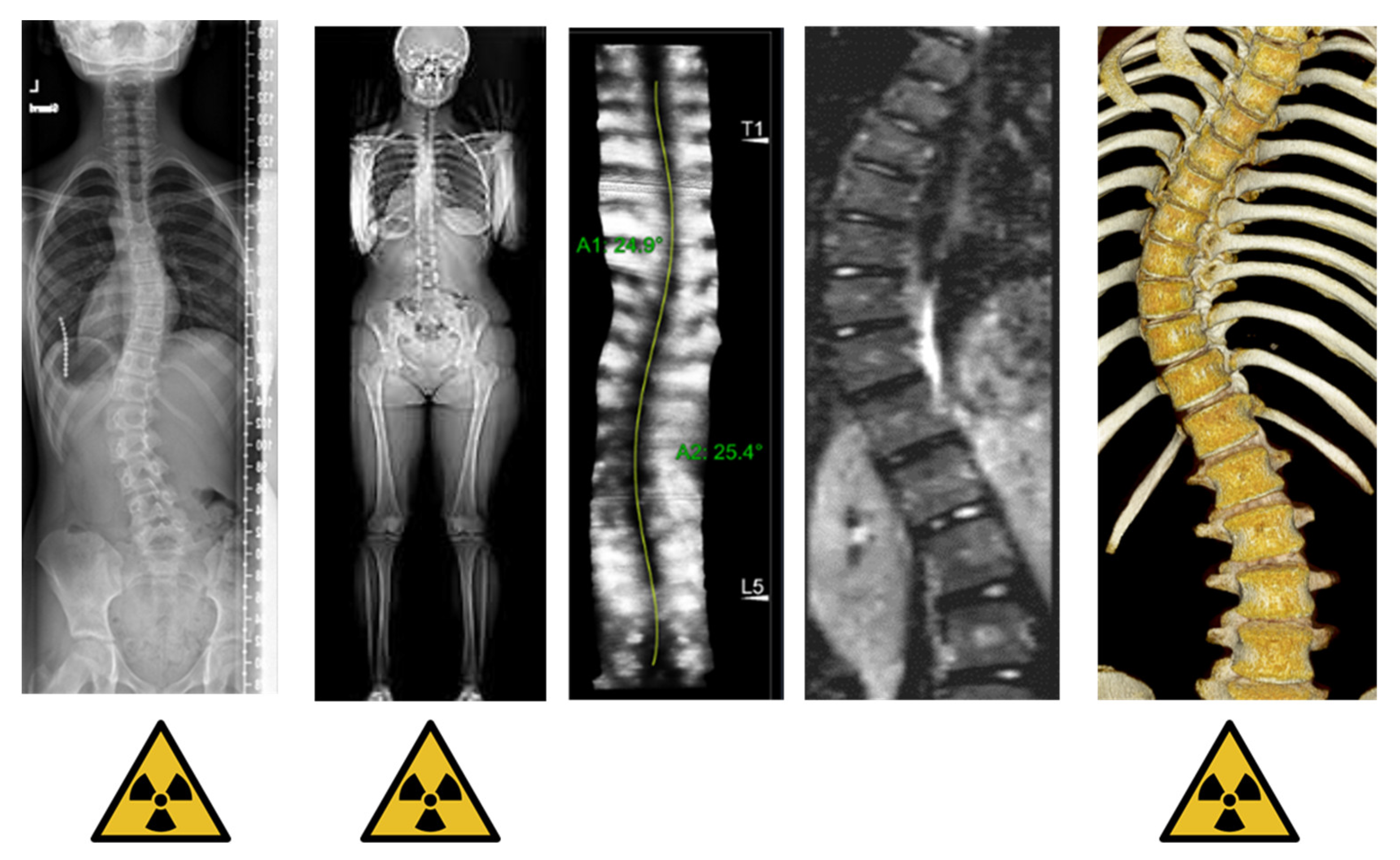 Healthcare free full text imaging methods to quantify the chest and