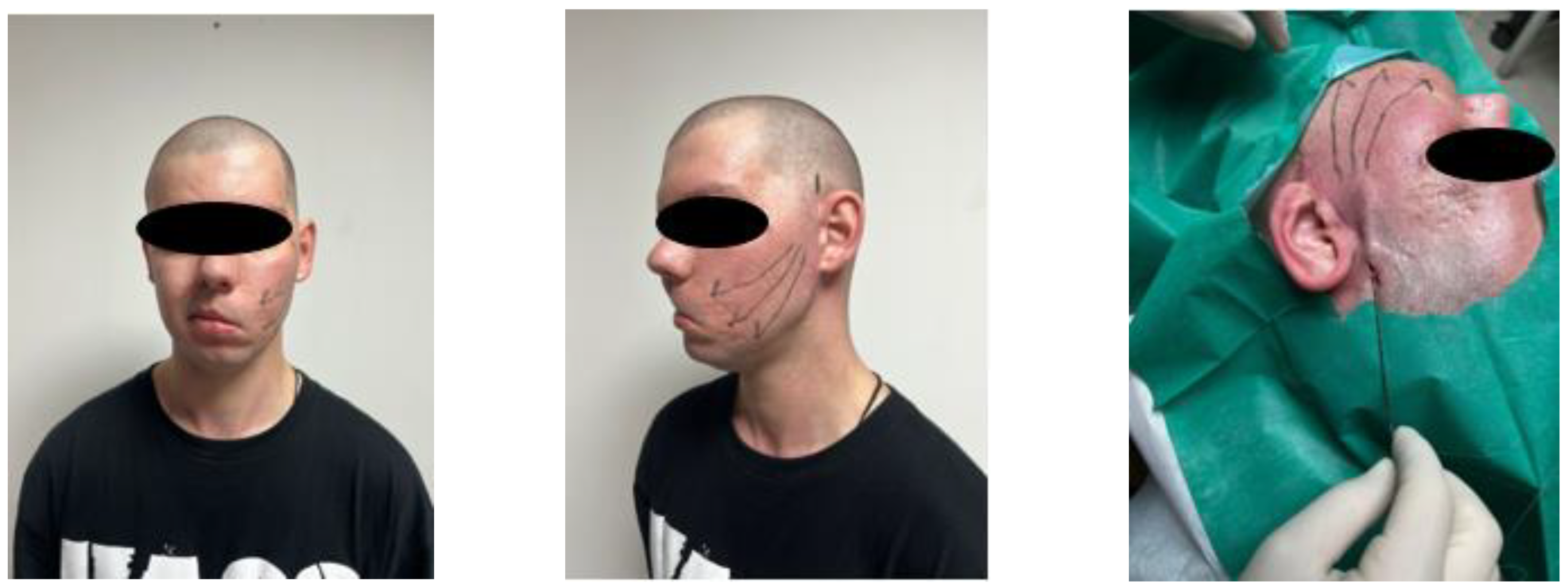 Healthcare 11 01490 g004a Healthcare 11 01490 g004a