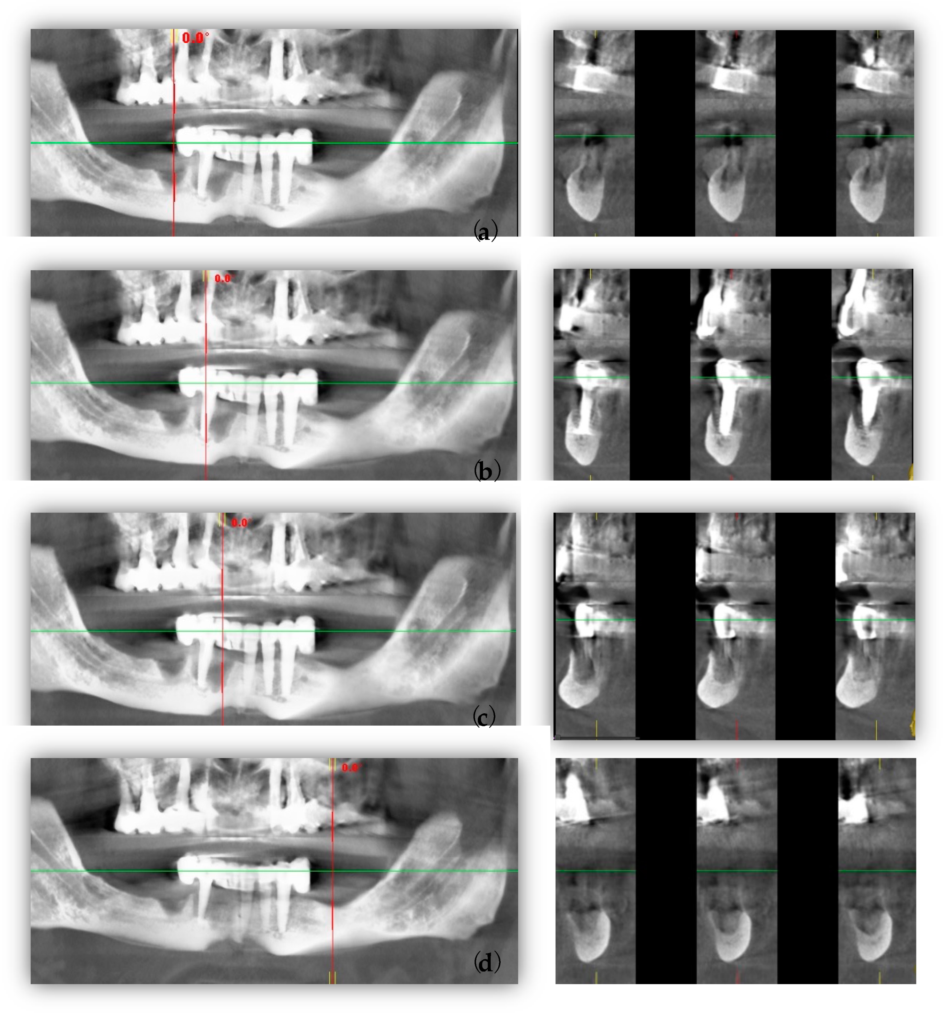 Healthcare 11 01608 g002