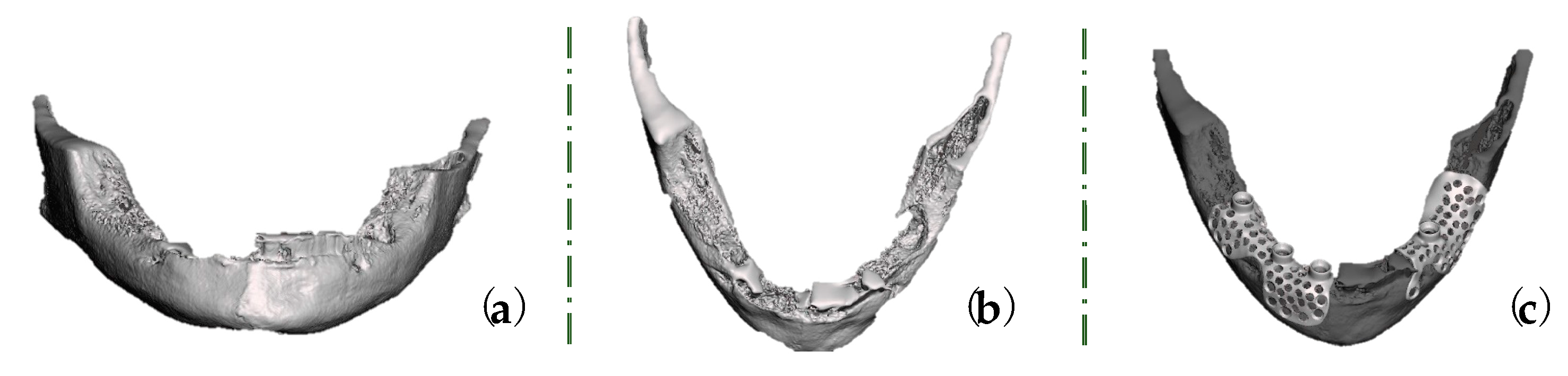 Healthcare 11 01608 g004