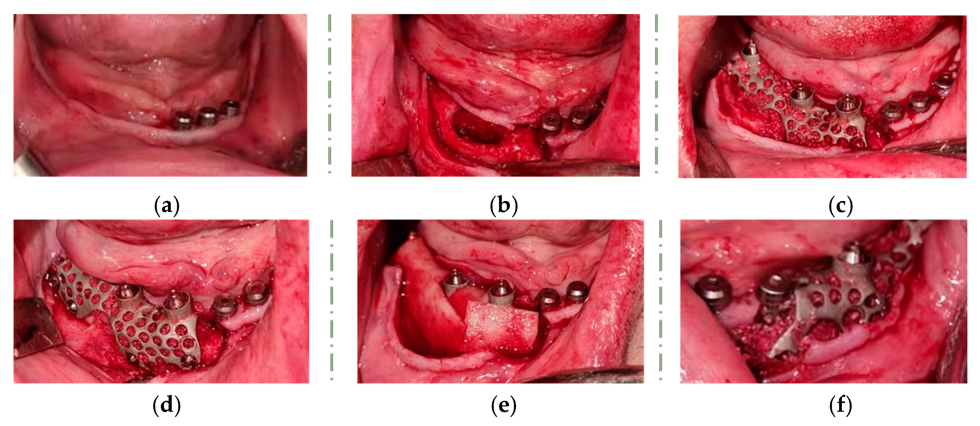 Healthcare 11 01608 g005