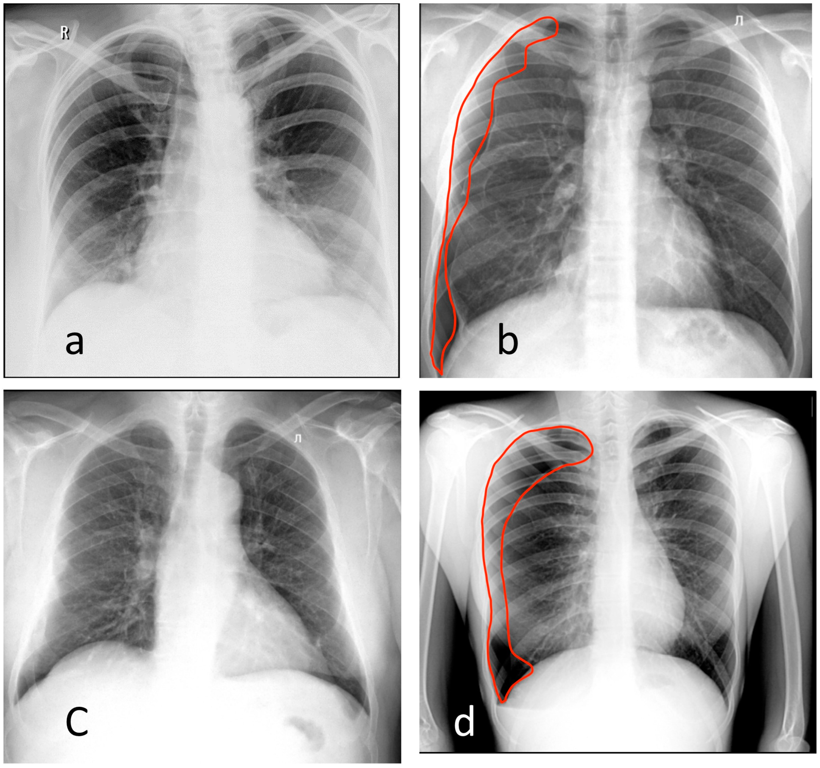 Healthcare 11 01684 g004