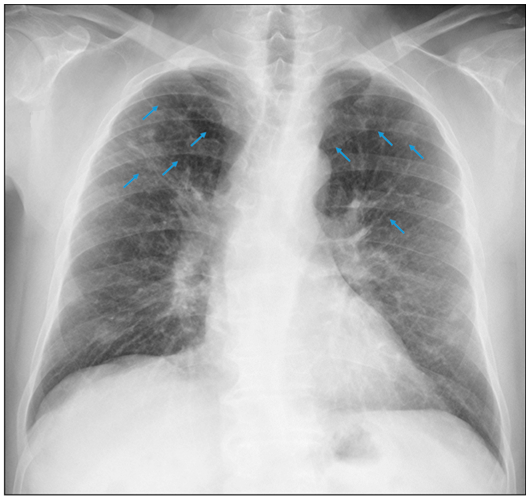 Healthcare 11 01782 g005