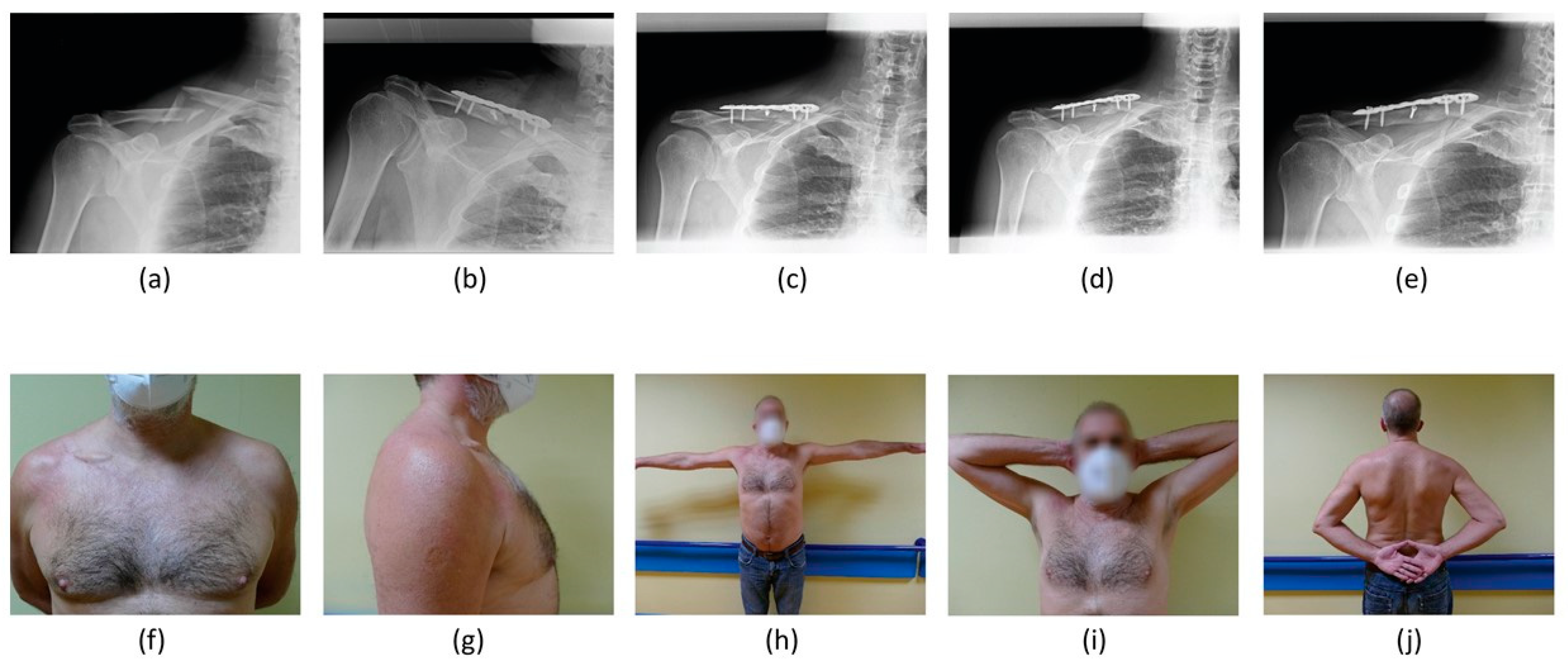 Healthcare Free FullText An Institutional Standardised Protocol