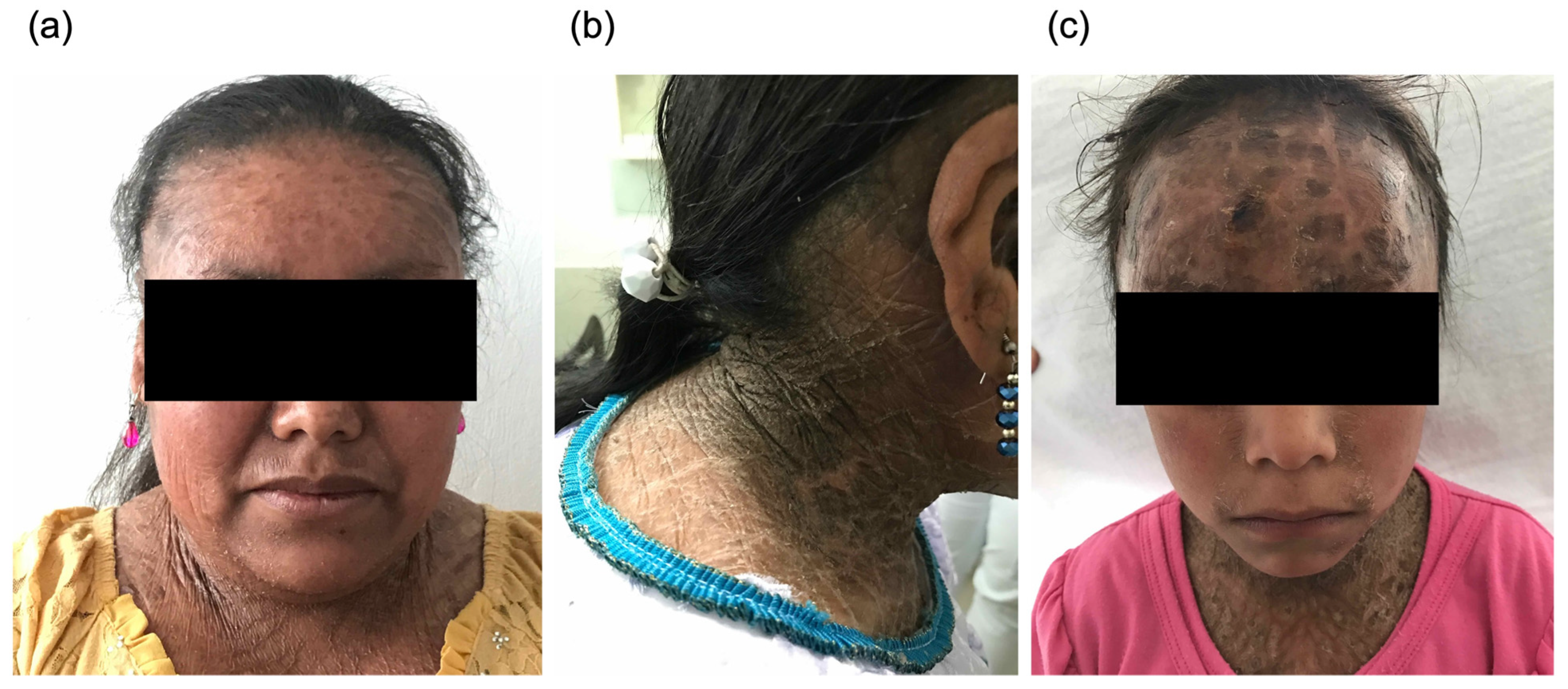 Healthcare 11 02071 g001 Healthcare 11 02071 g001