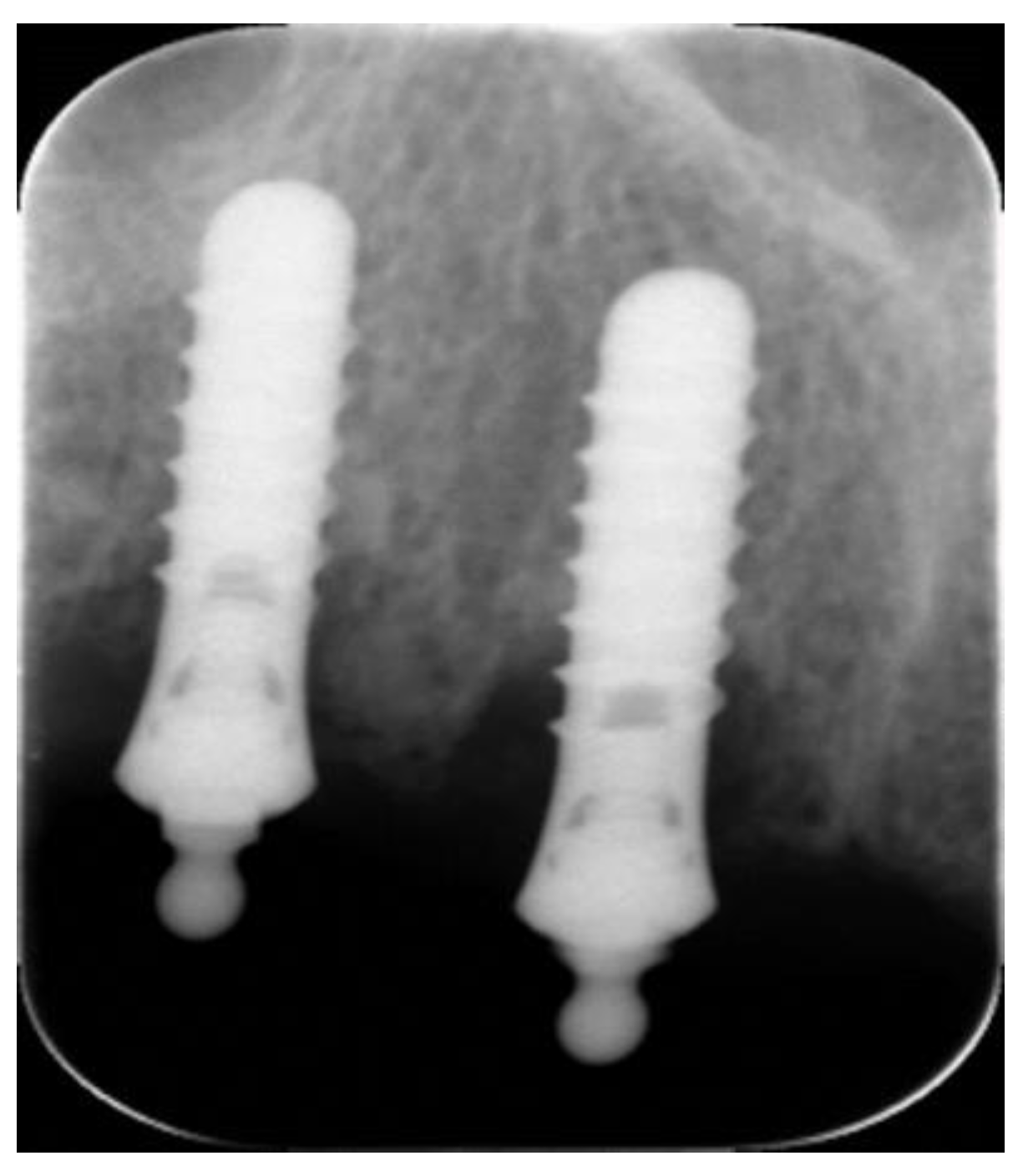 Healthcare 11 02201 g002 Healthcare 11 02201 g002