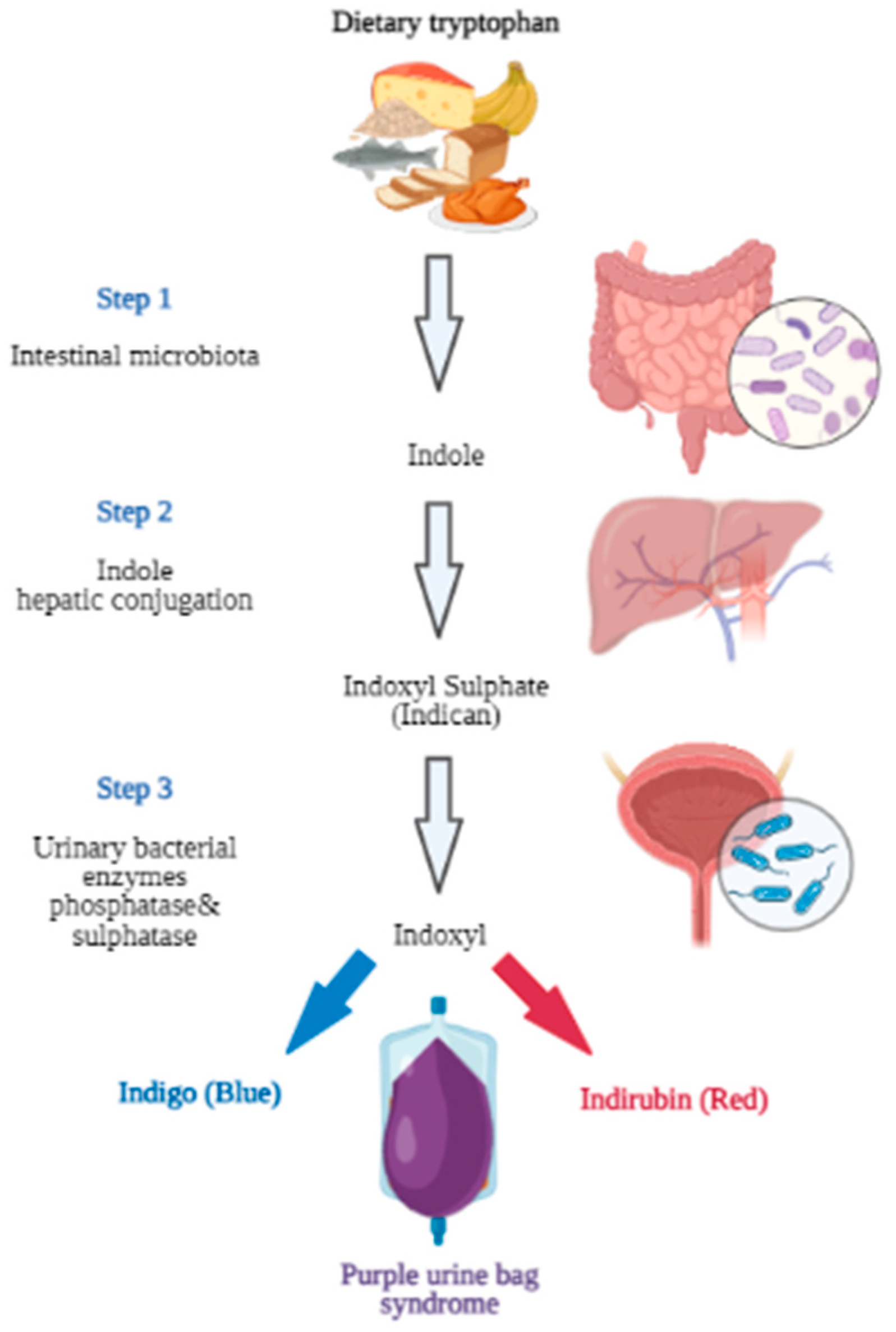 Urinary Diversion - NIDDK