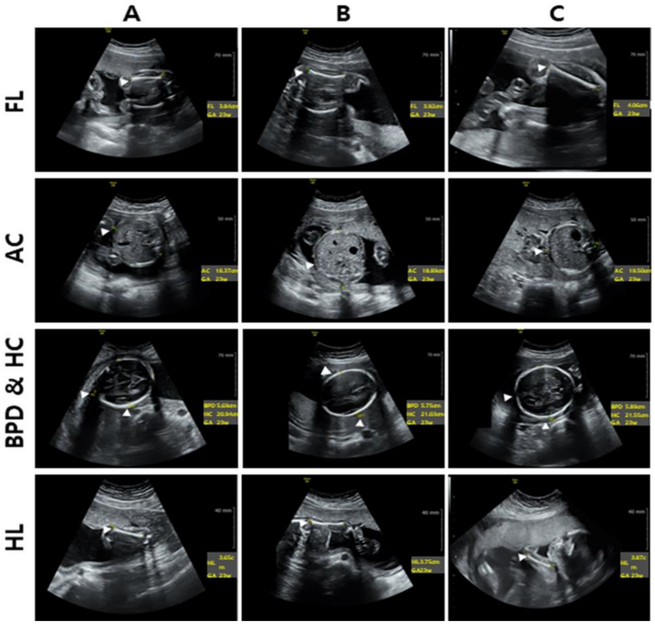 Healthcare 11 02325 g003 Healthcare 11 02325 g003