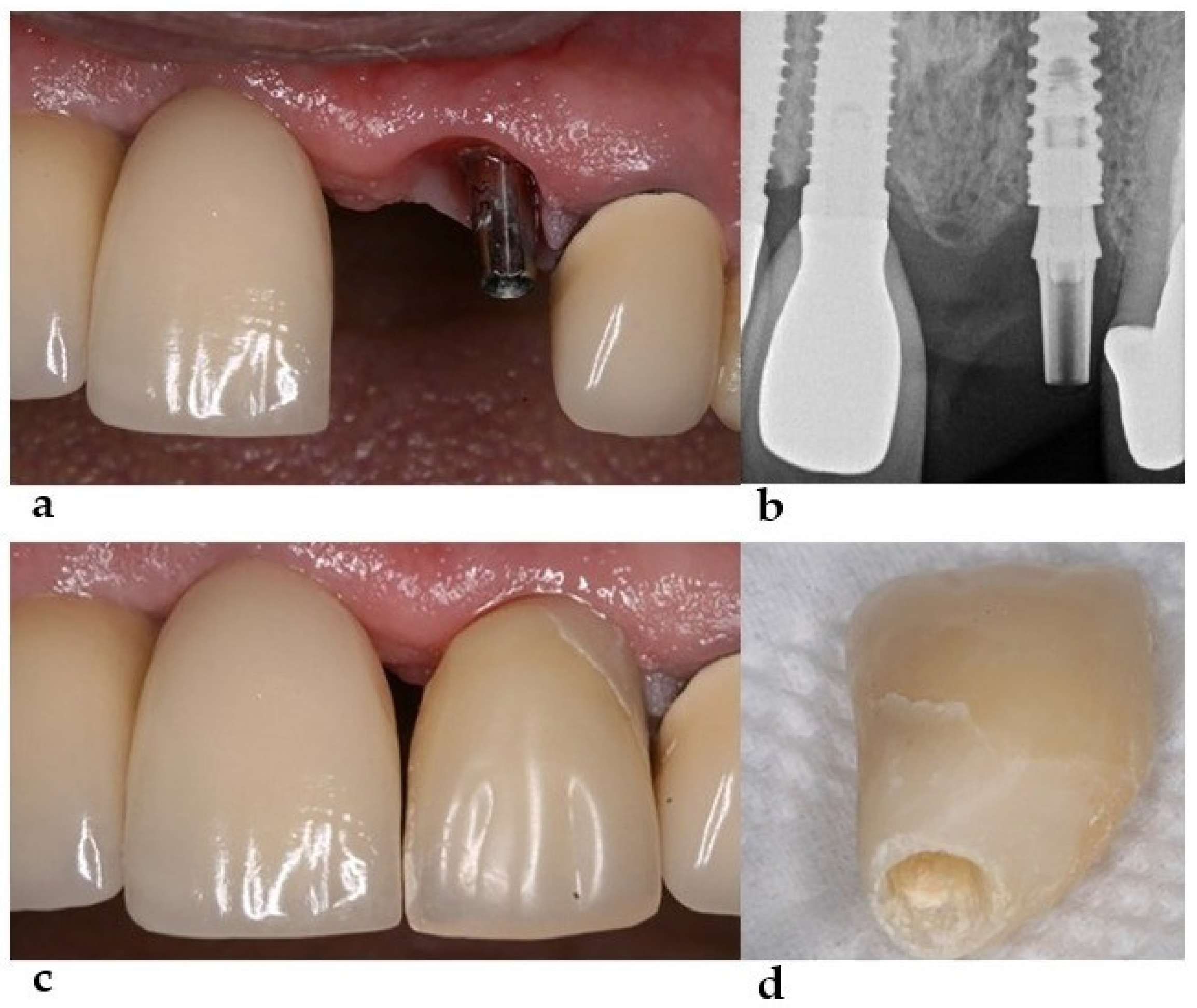 Healthcare 11 02472 g002 Healthcare 11 02472 g002