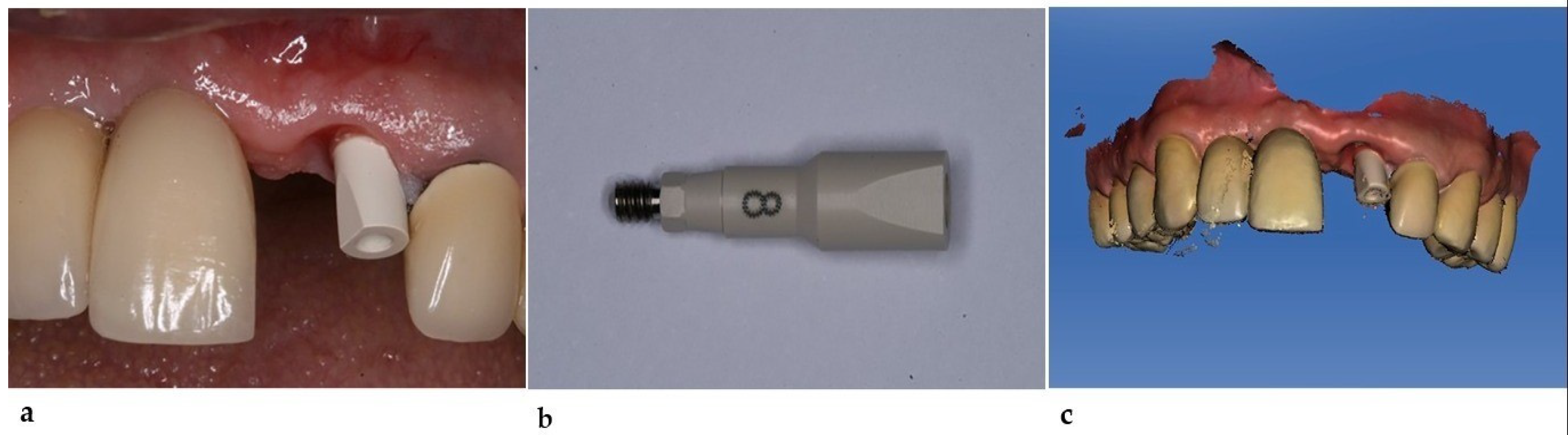 Healthcare 11 02472 g003 Healthcare 11 02472 g003